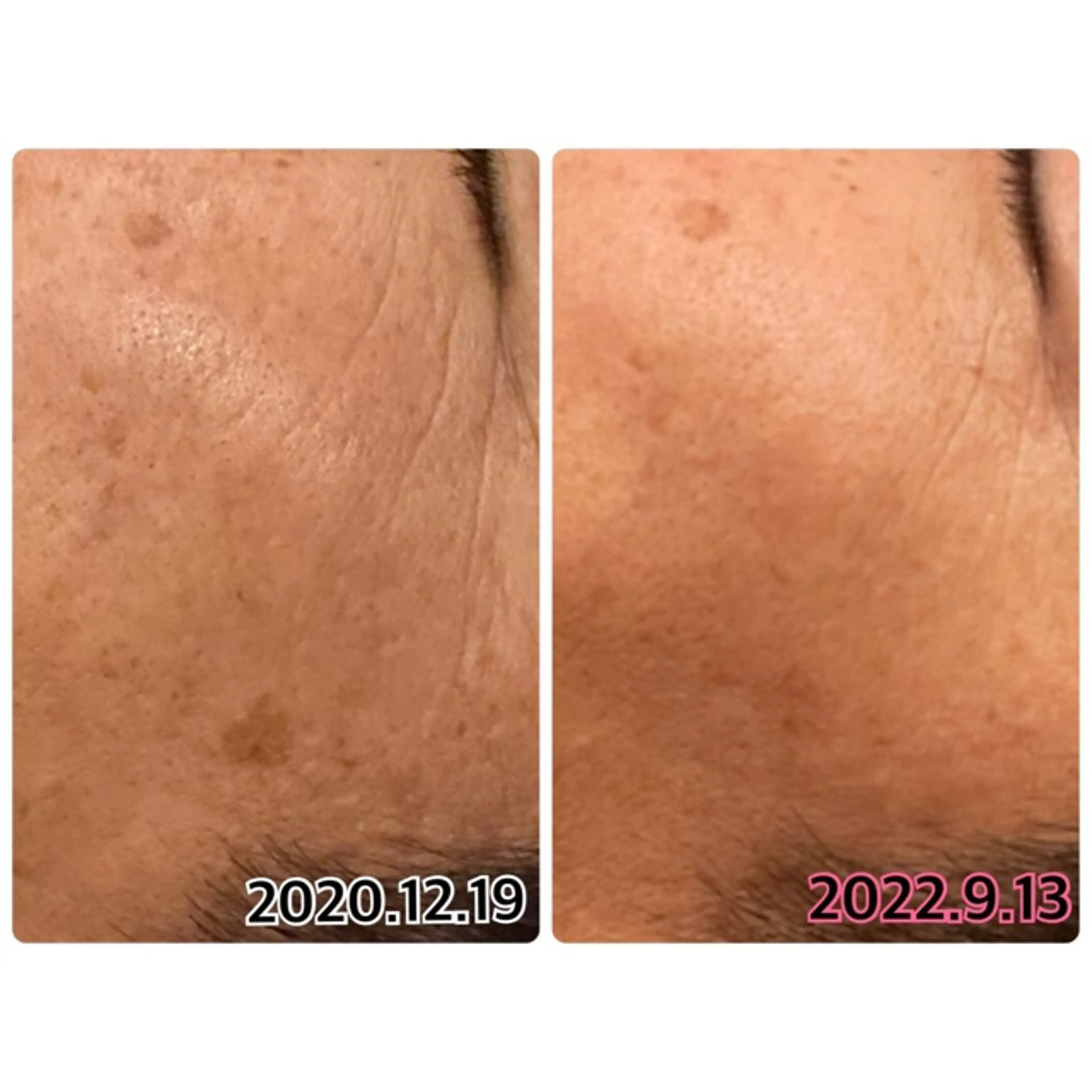 その他 上野 伊久美のその他イメージ