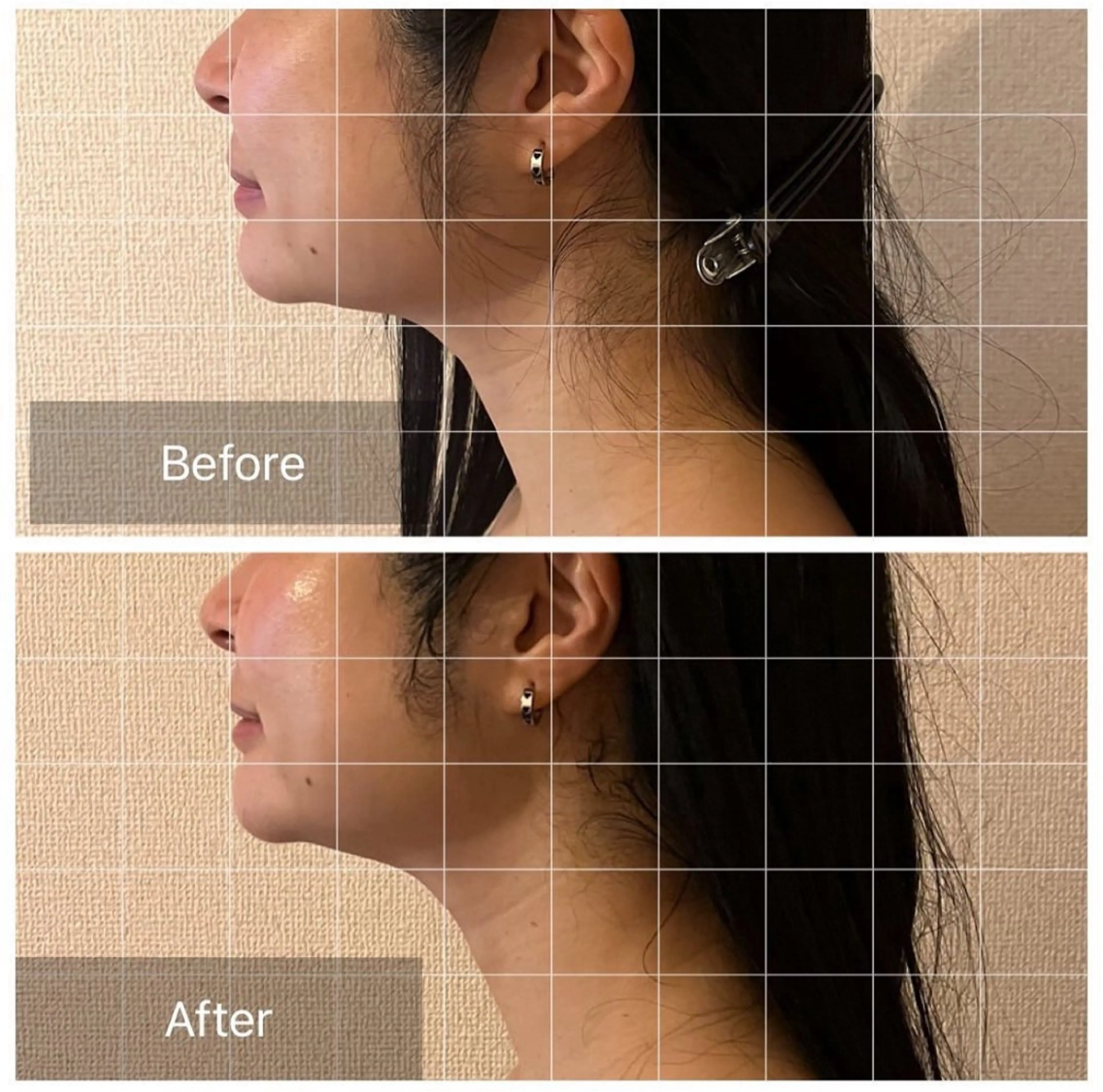 エステ リラク 表情筋フェイシャル 三軒茶屋のエステ・リラクイメージ