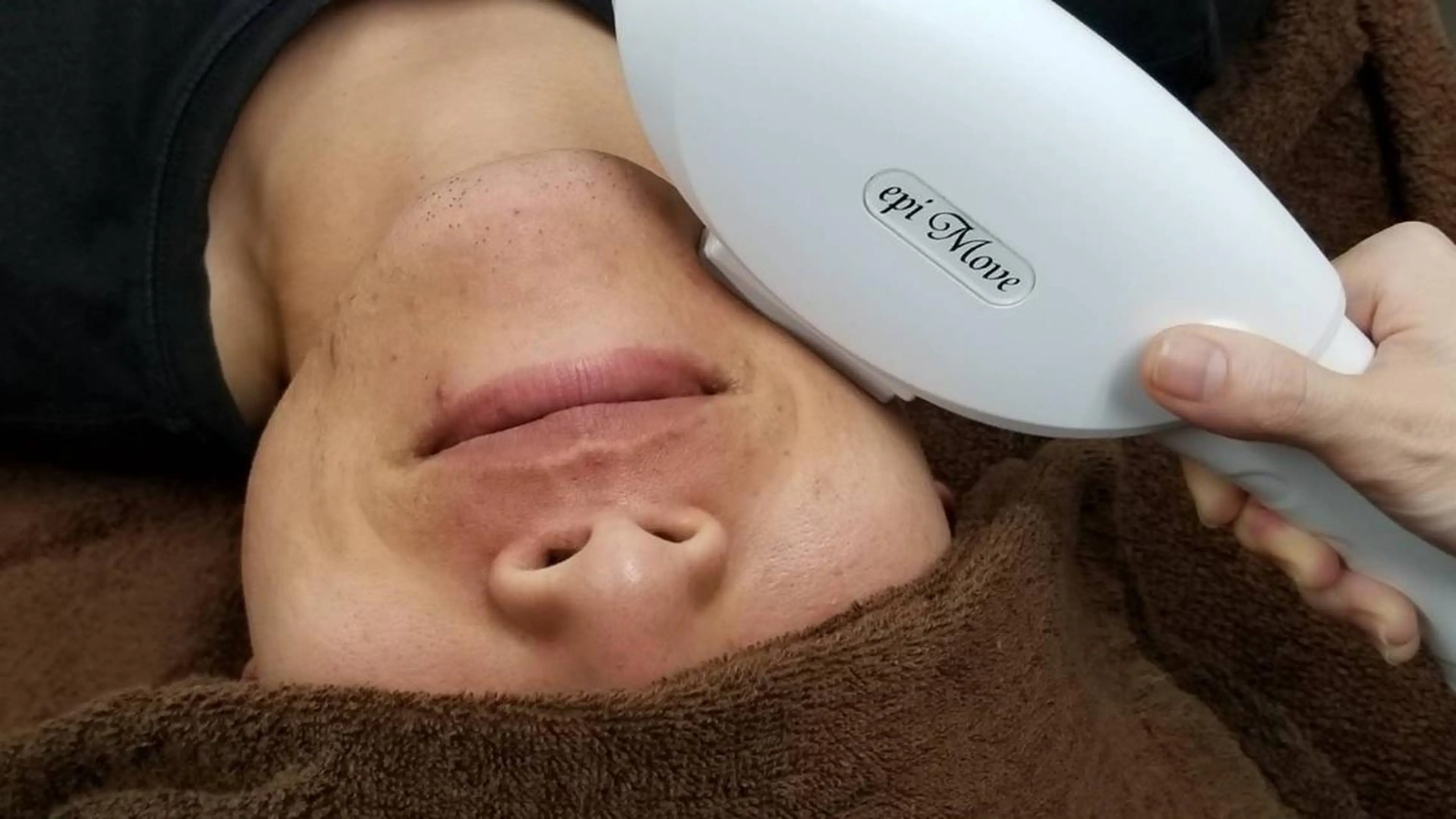 【メンズ】ヒゲ脱毛(ほほ・口周り・あご下・くび)+カウンセリング ♪保湿ケア付♪の写真