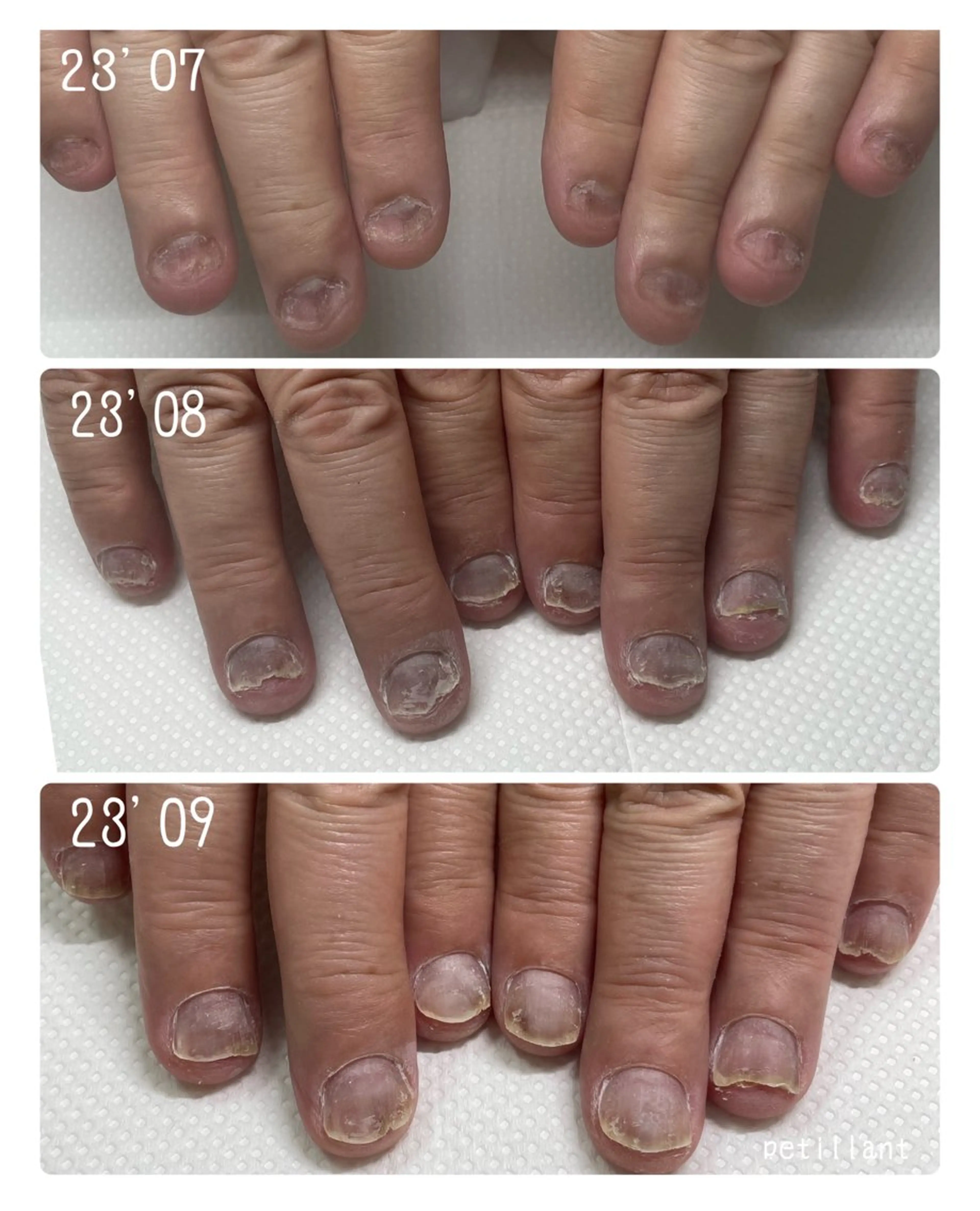 ネイル 長さ出し ジェルネイル nail salon petillantのネイルデザイン