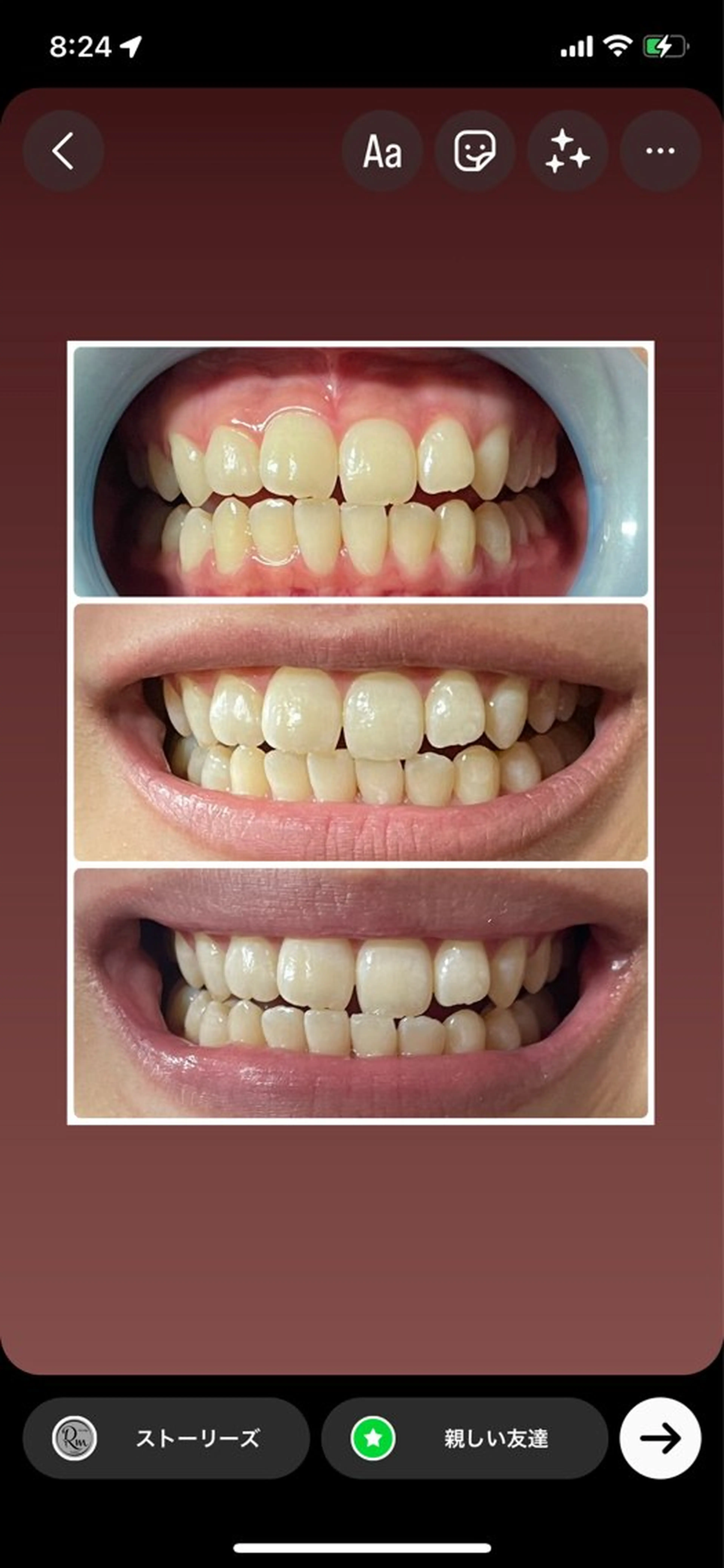 その他 エステ／ネイル/脱毛 R.Msalonのネイルデザイン