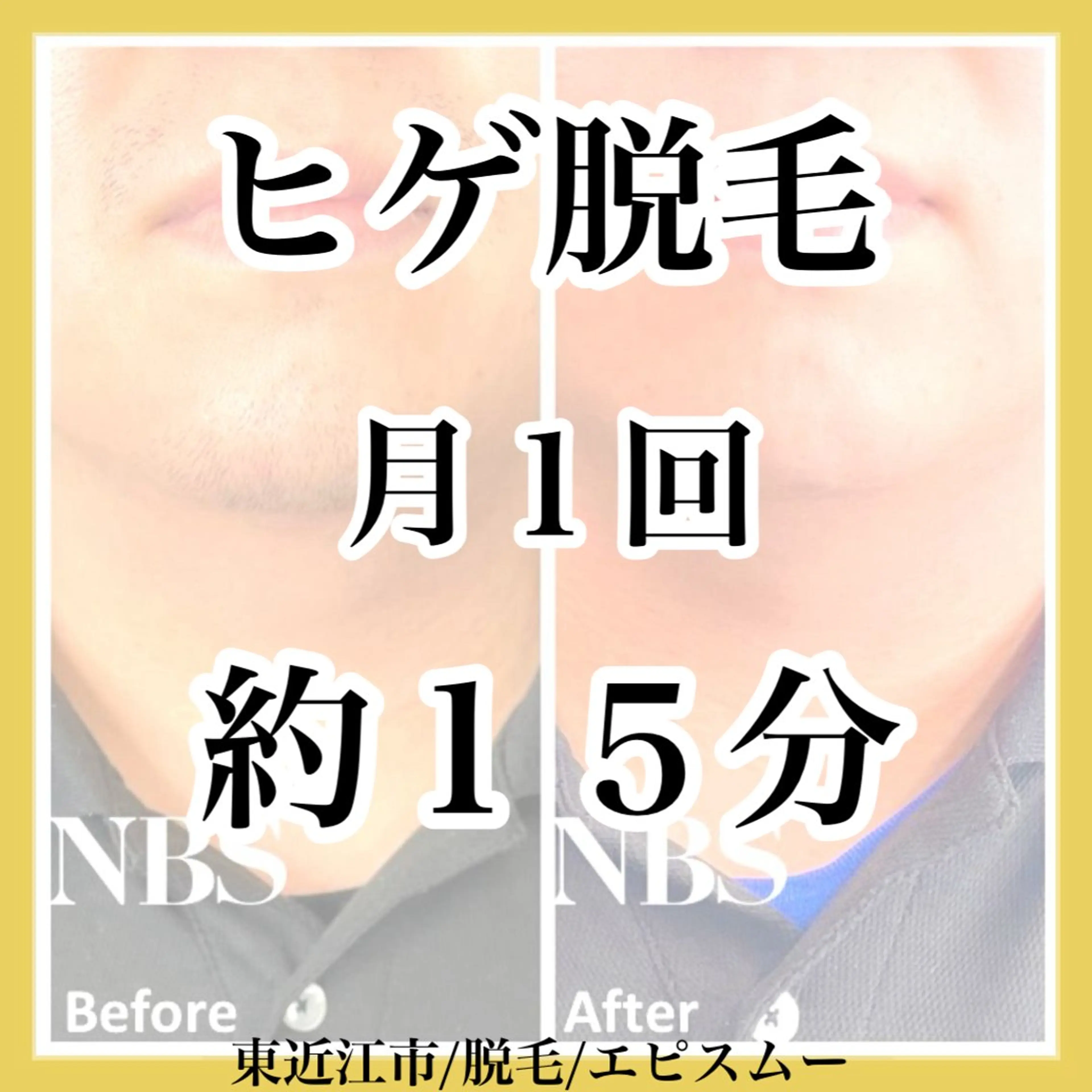 メンズ epismoo 脱毛/HBL/毛穴の眉毛・アイブロウイメージ