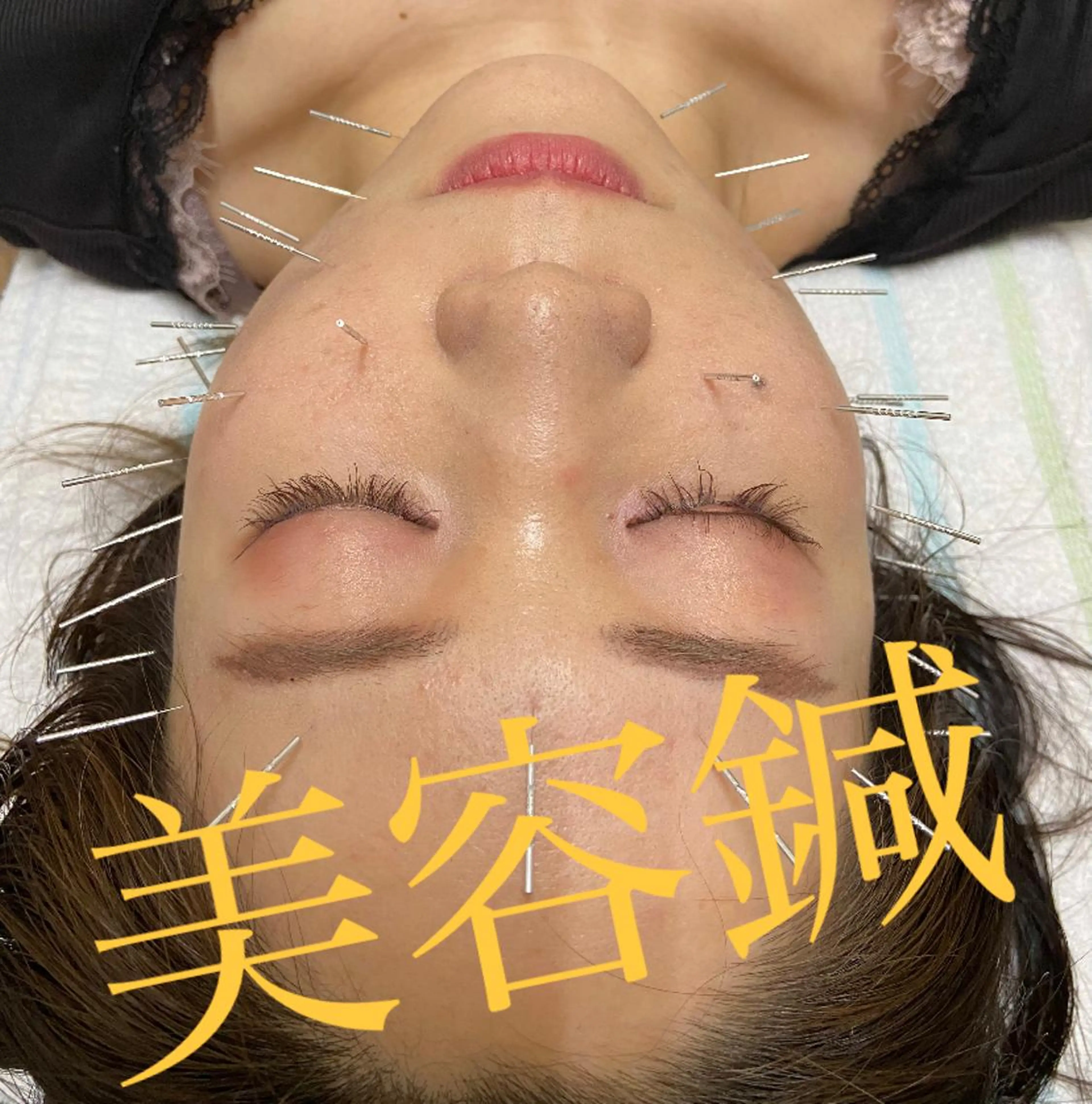 美容鍼灸サロン REPOSのその他イメージ