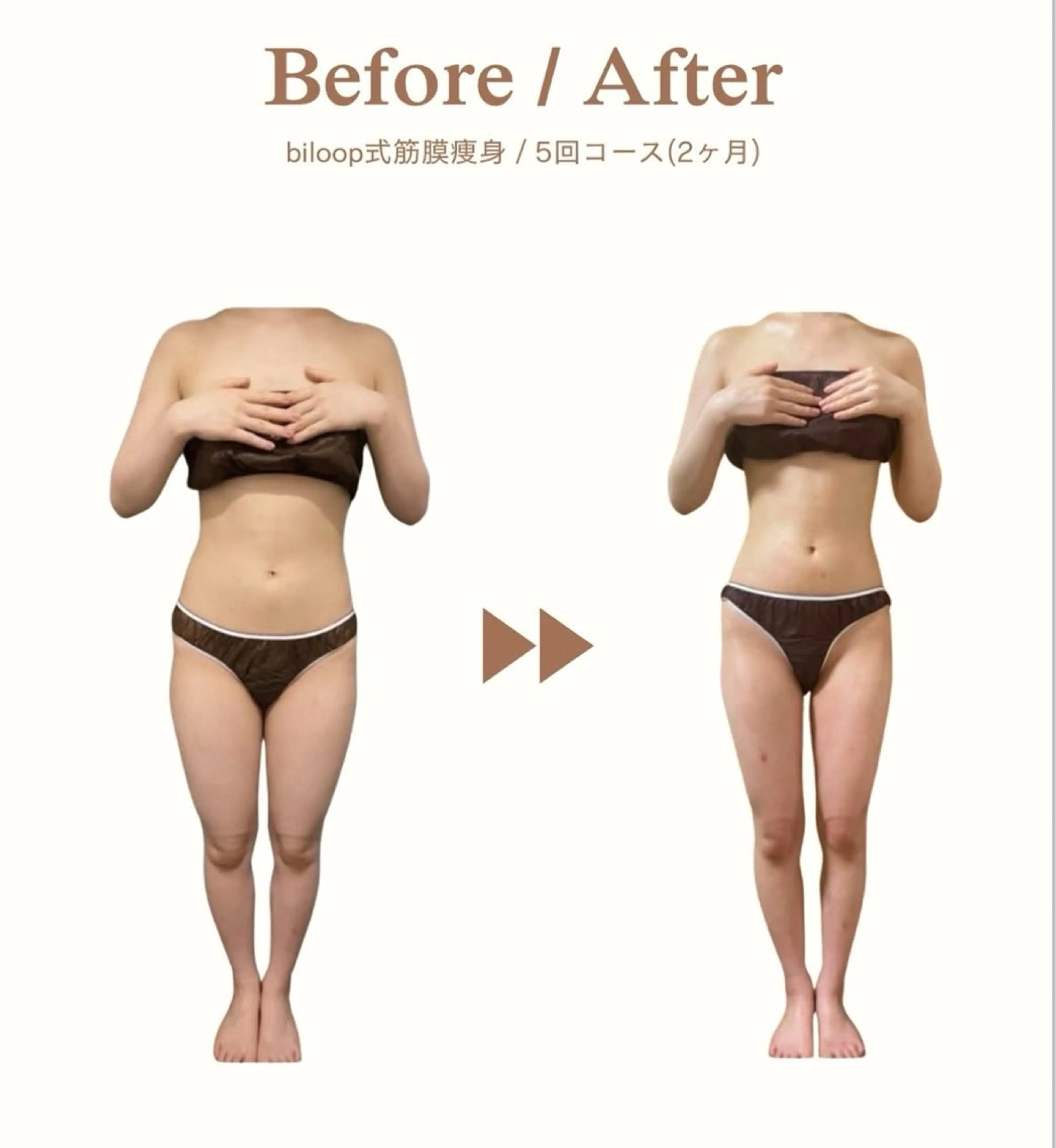 《biloop式筋膜痩身5回コース🌿》ボディメイク＆痩せ体質へ✨(1回あたり12,100円)の写真