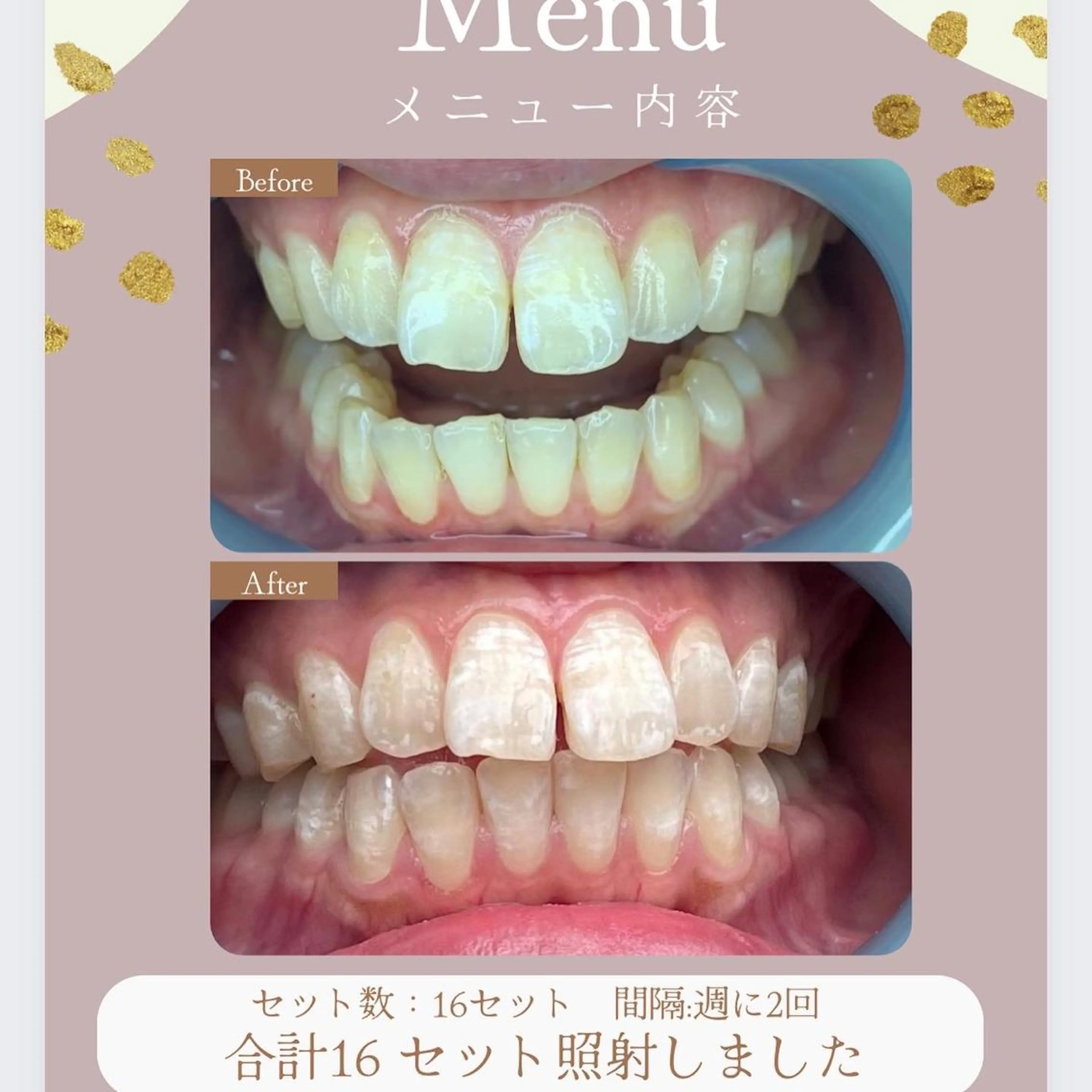 LAVISH nail salonのヘアスタイル