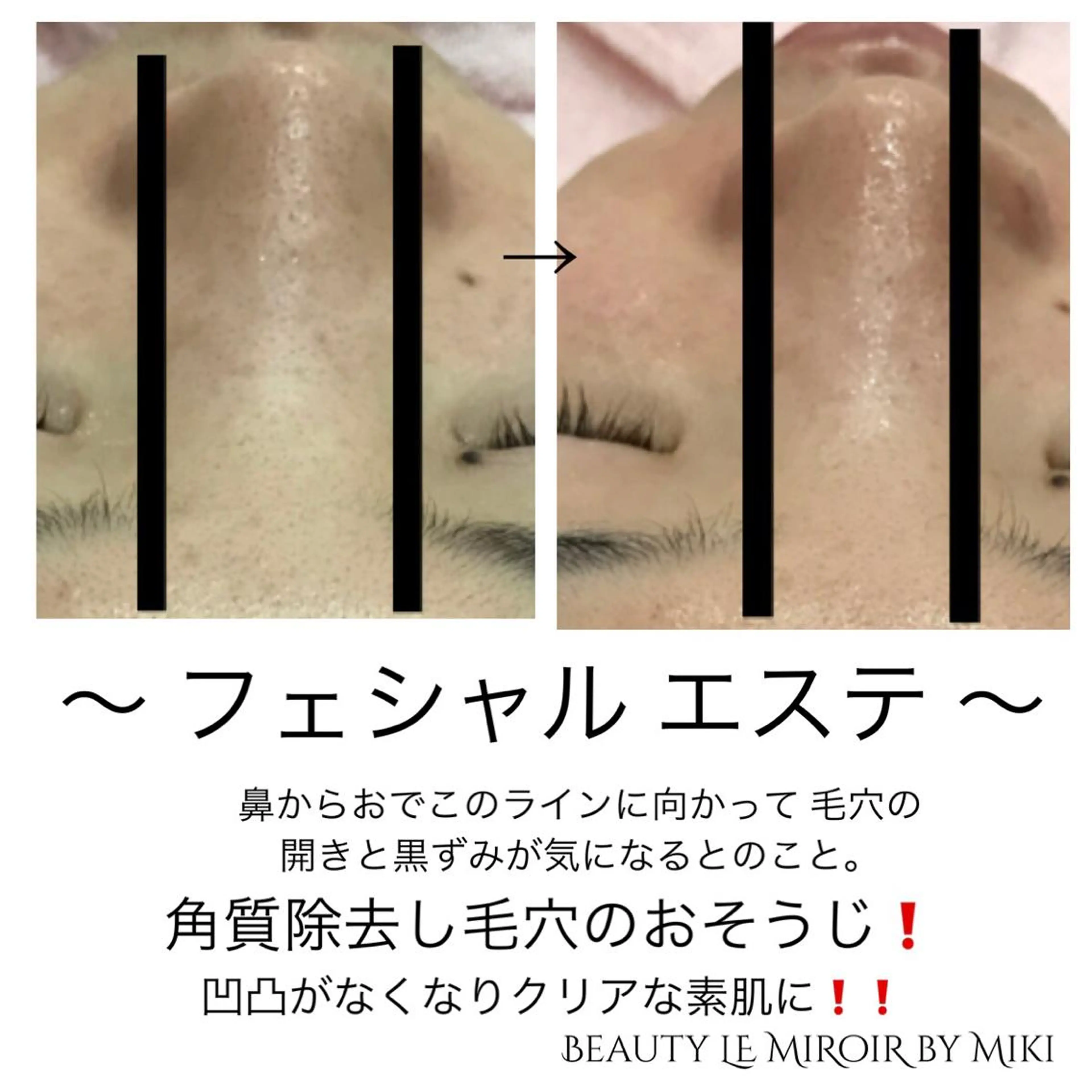 ビューティー ミロワールのエステ・リラクイメージ