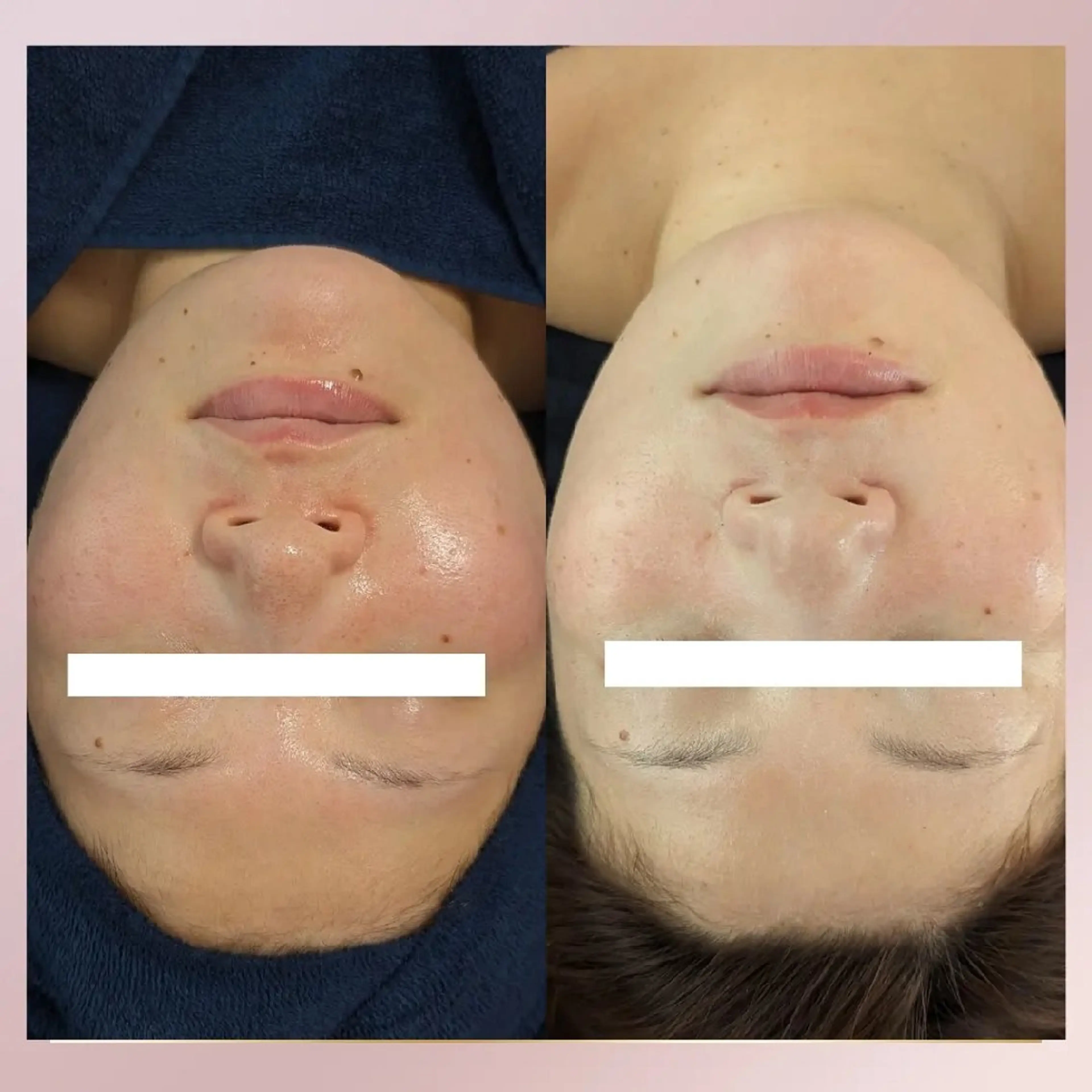 MI KUのエステ・リラクイメージ