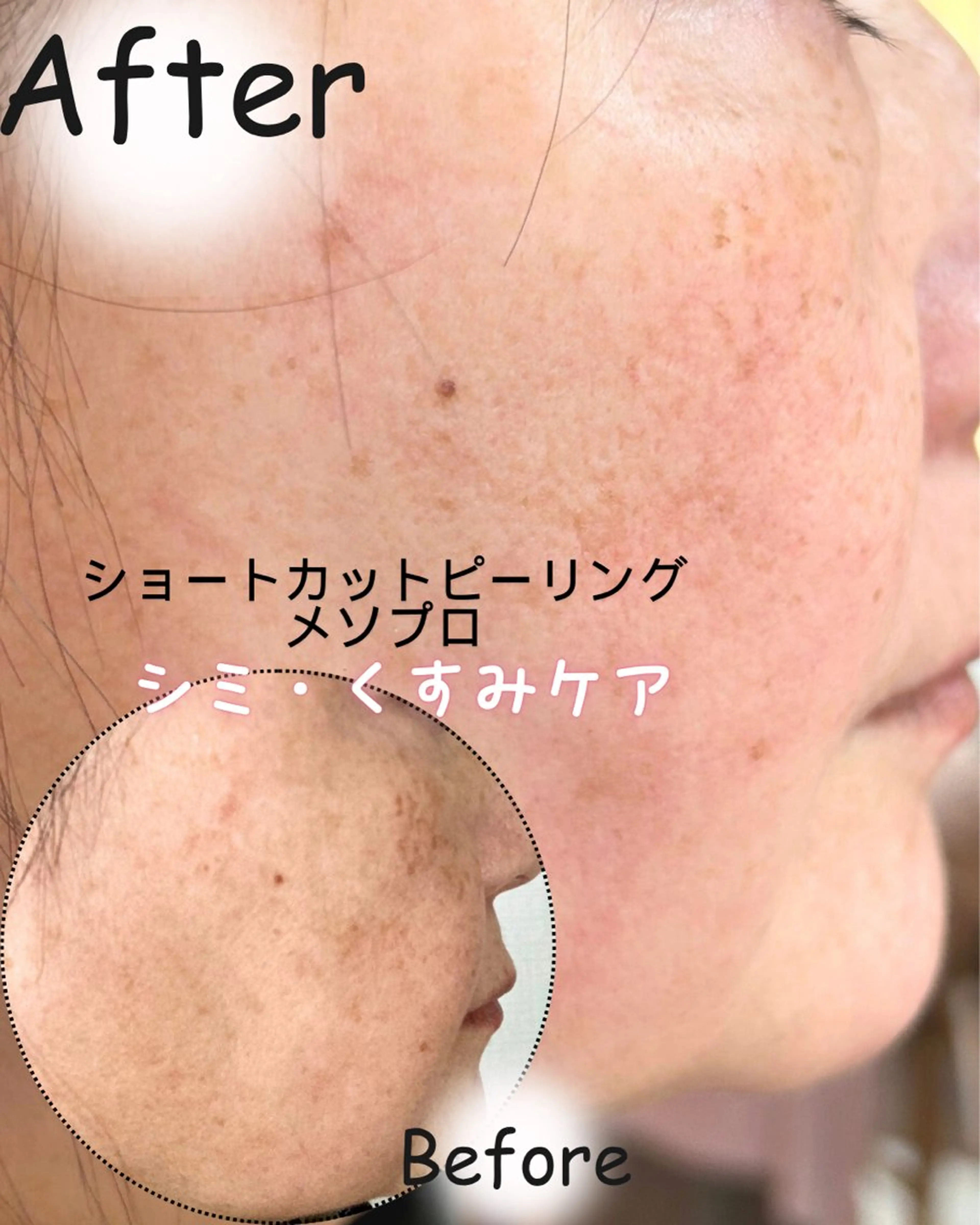 その他 リンパ・小顔サロン PuReTeのエステ・リラクイメージ