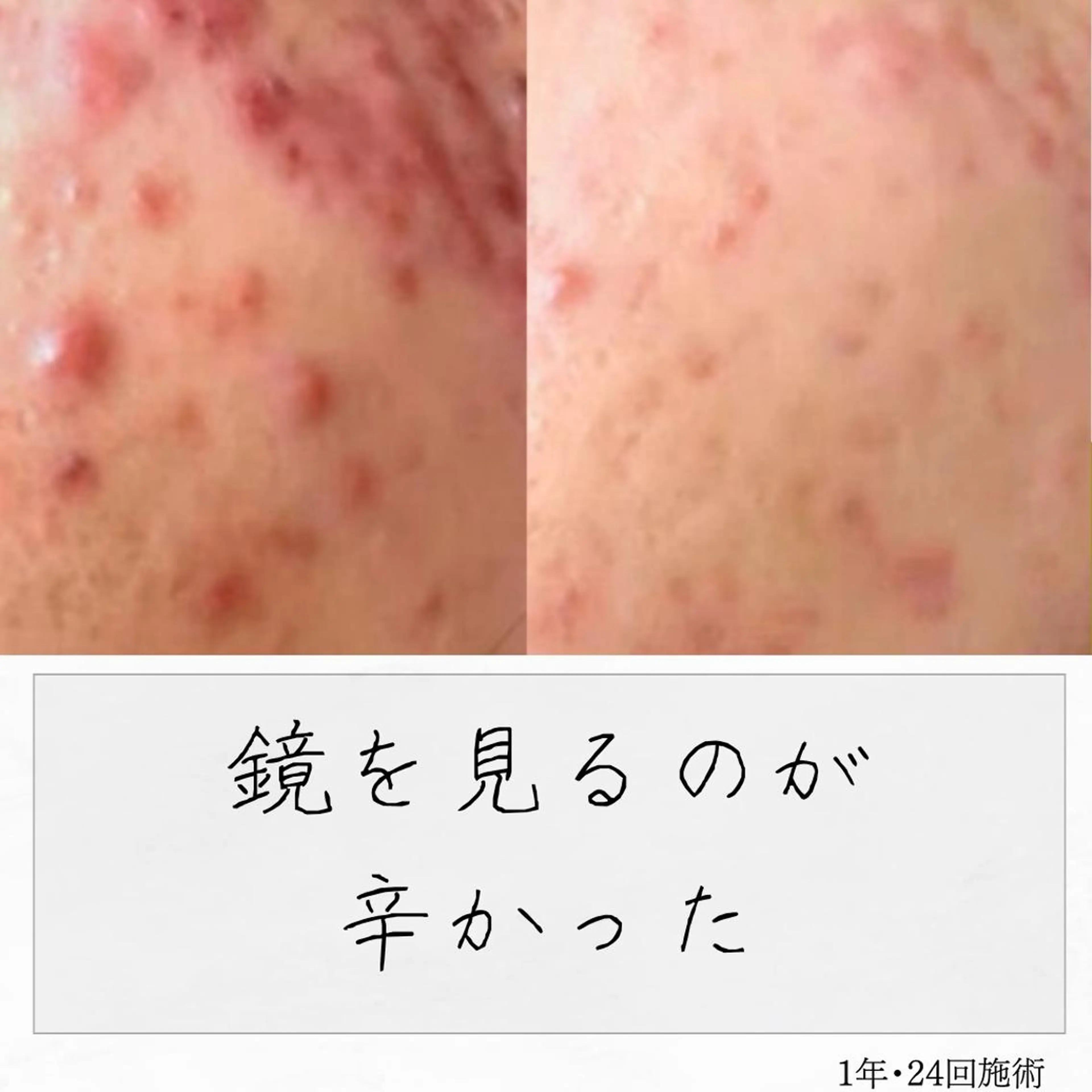 ニキビ経験者が施術 する専門サロン🌻のエステ・リラクイメージ