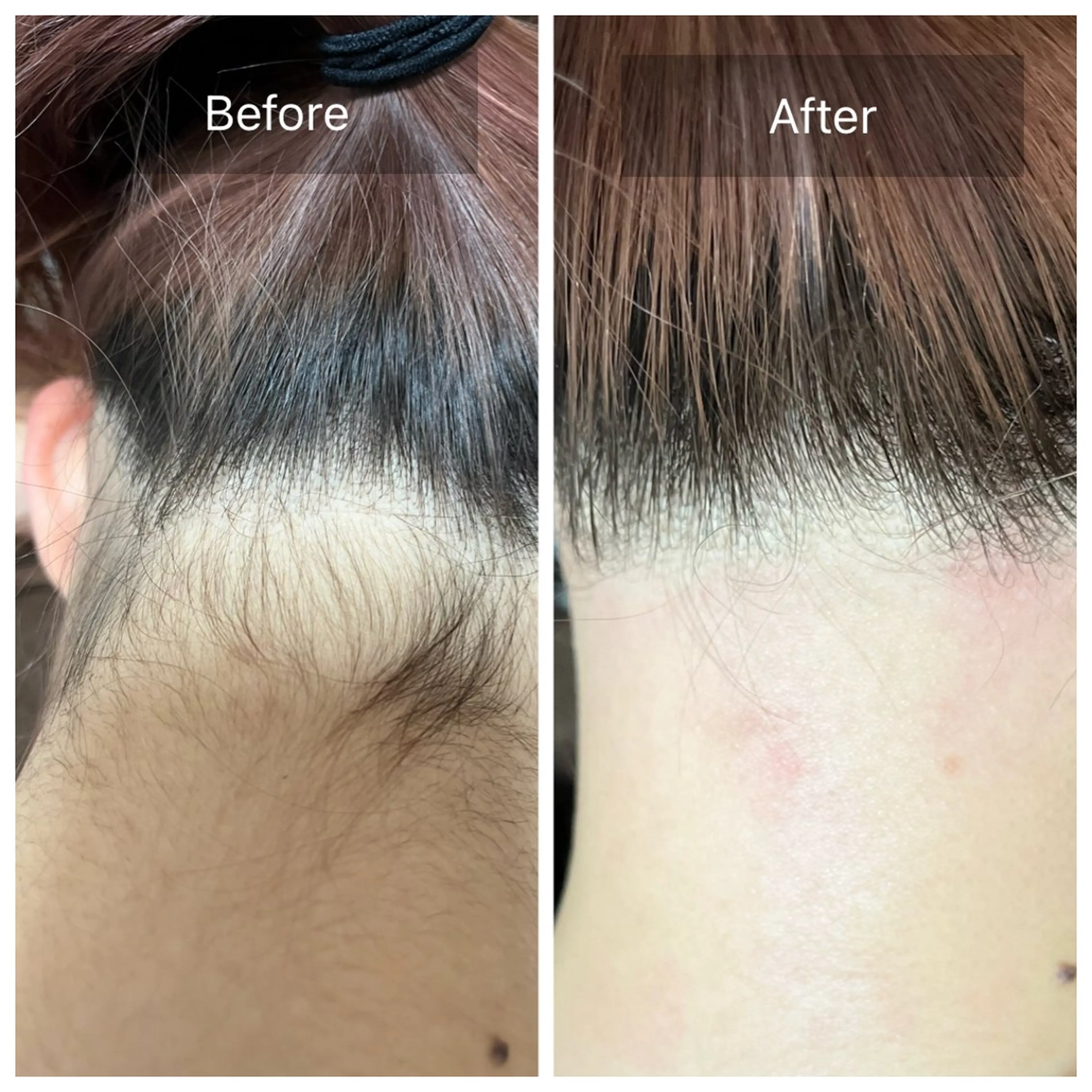 脱毛 Salon Improveのネイルデザイン