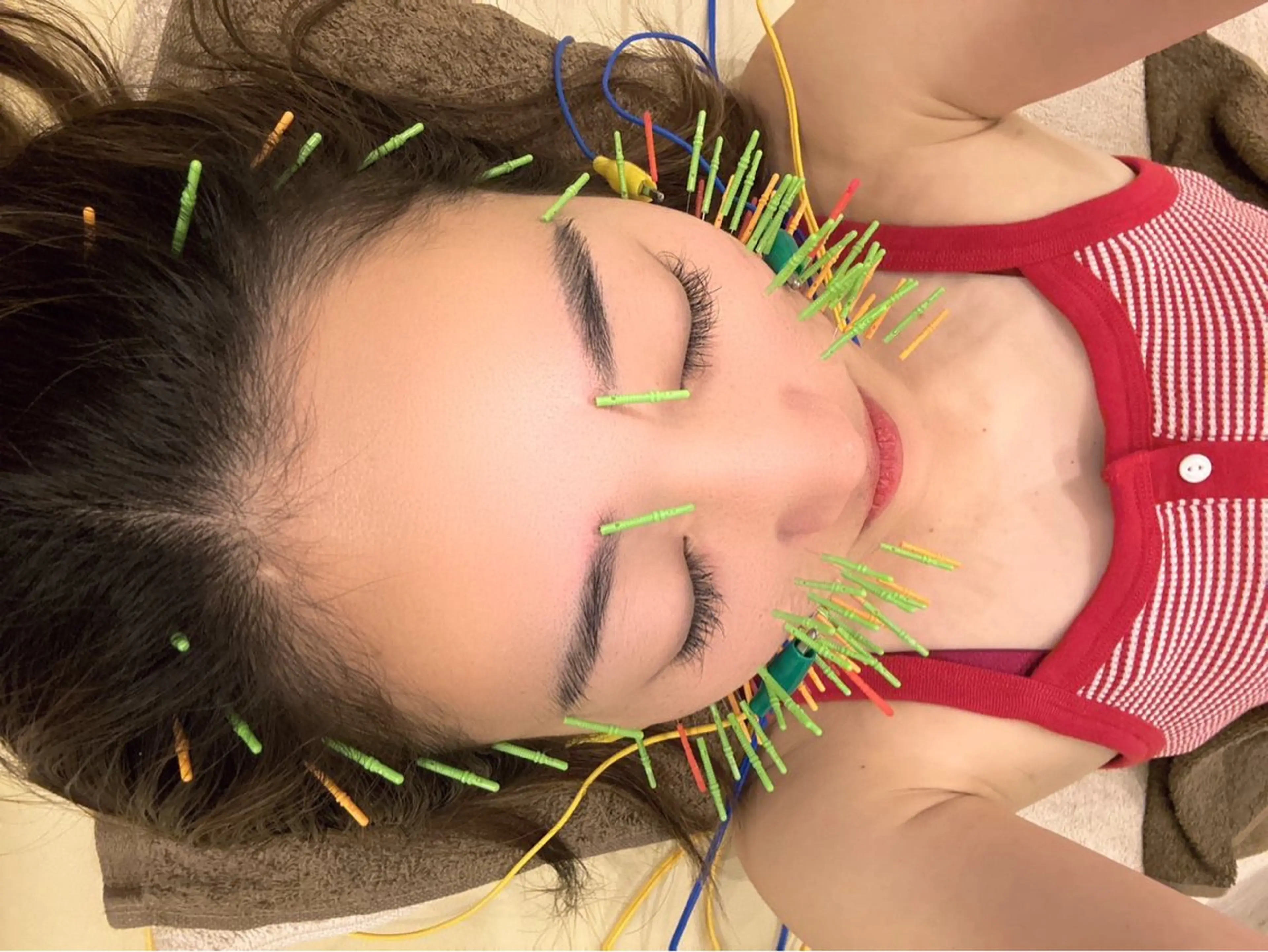 エステ リラク 肌質改善×美容鍼 ゆいのエステ・リラクイメージ