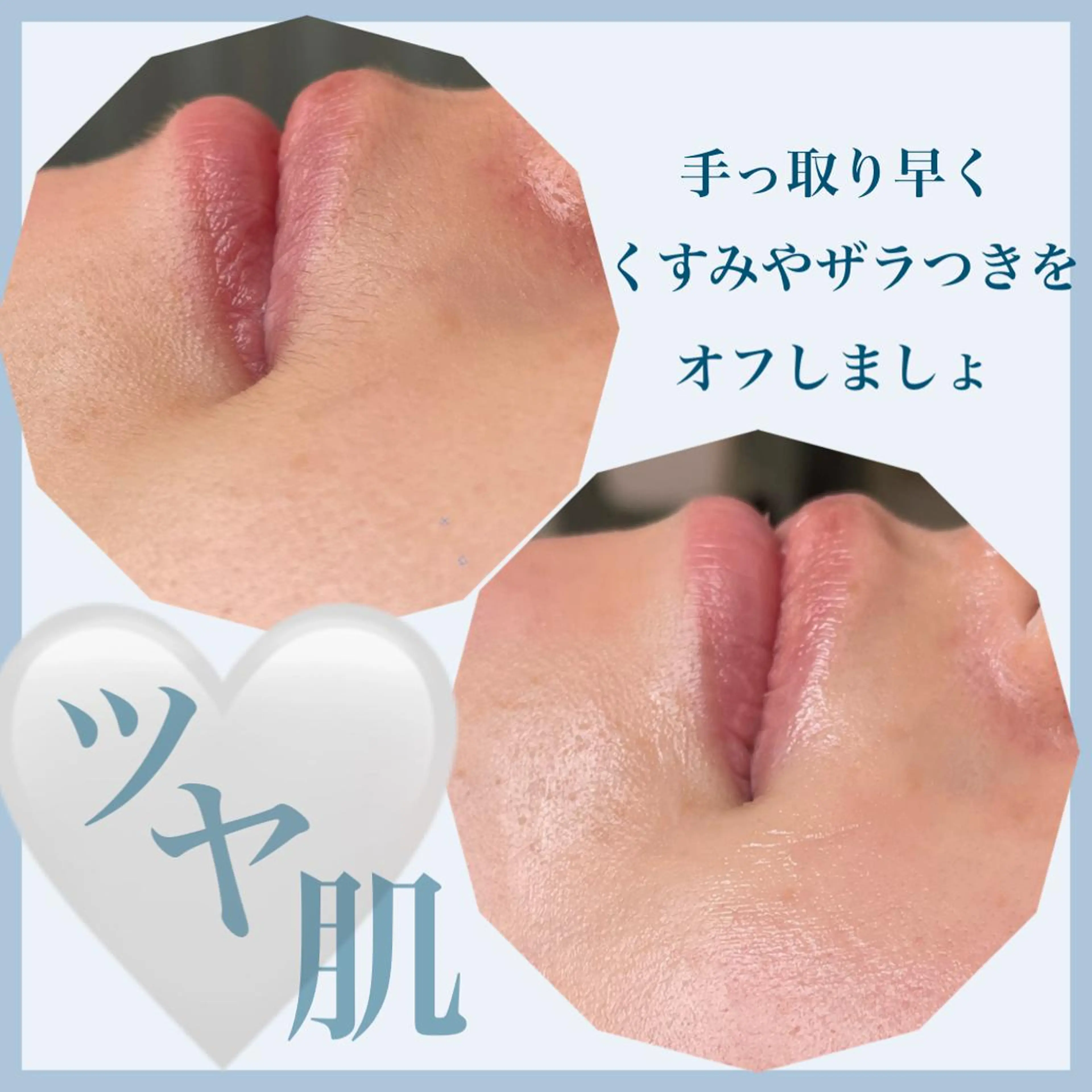 amu nail. RINAのネイルデザイン