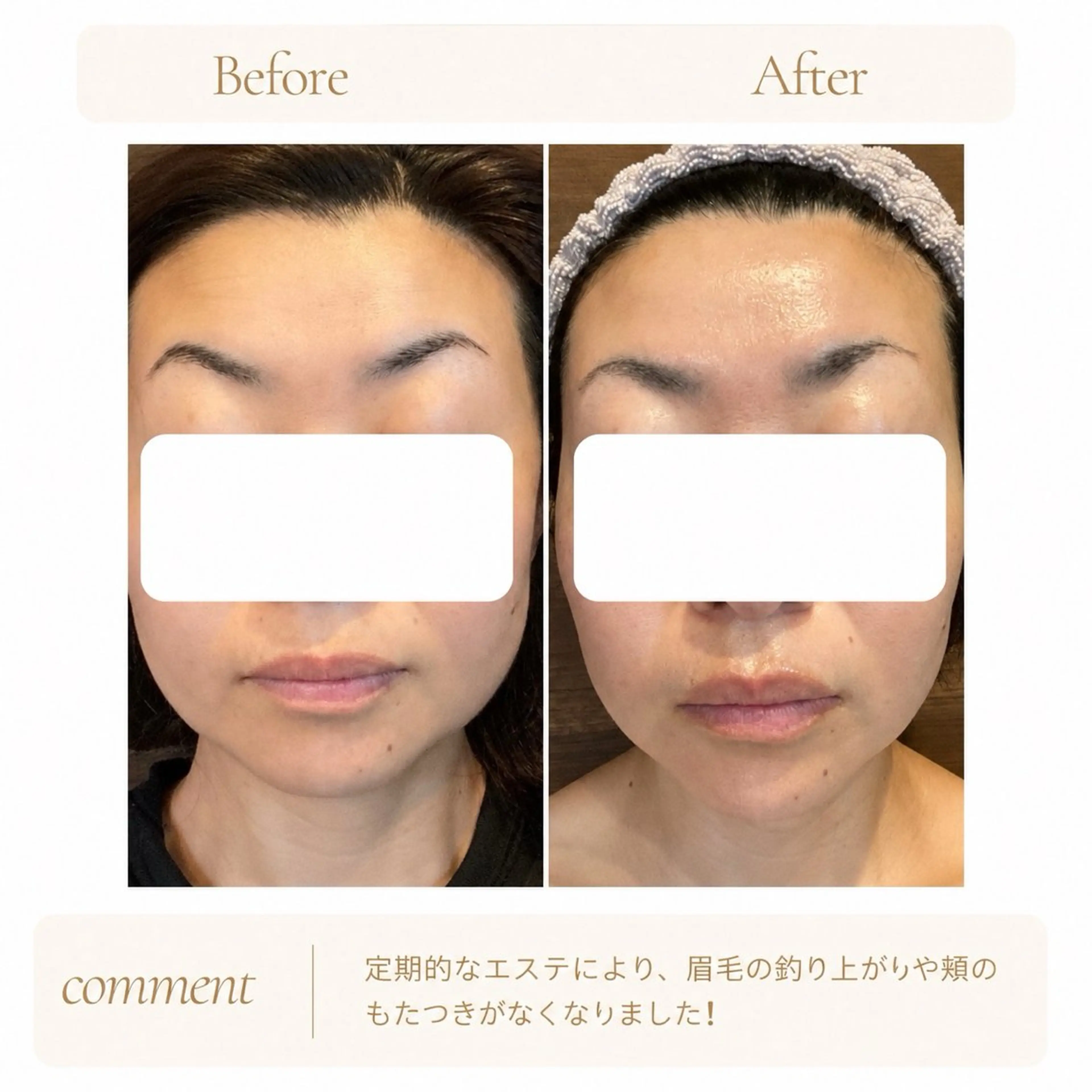 エステ SR SALON Michiのエステ・リラクイメージ