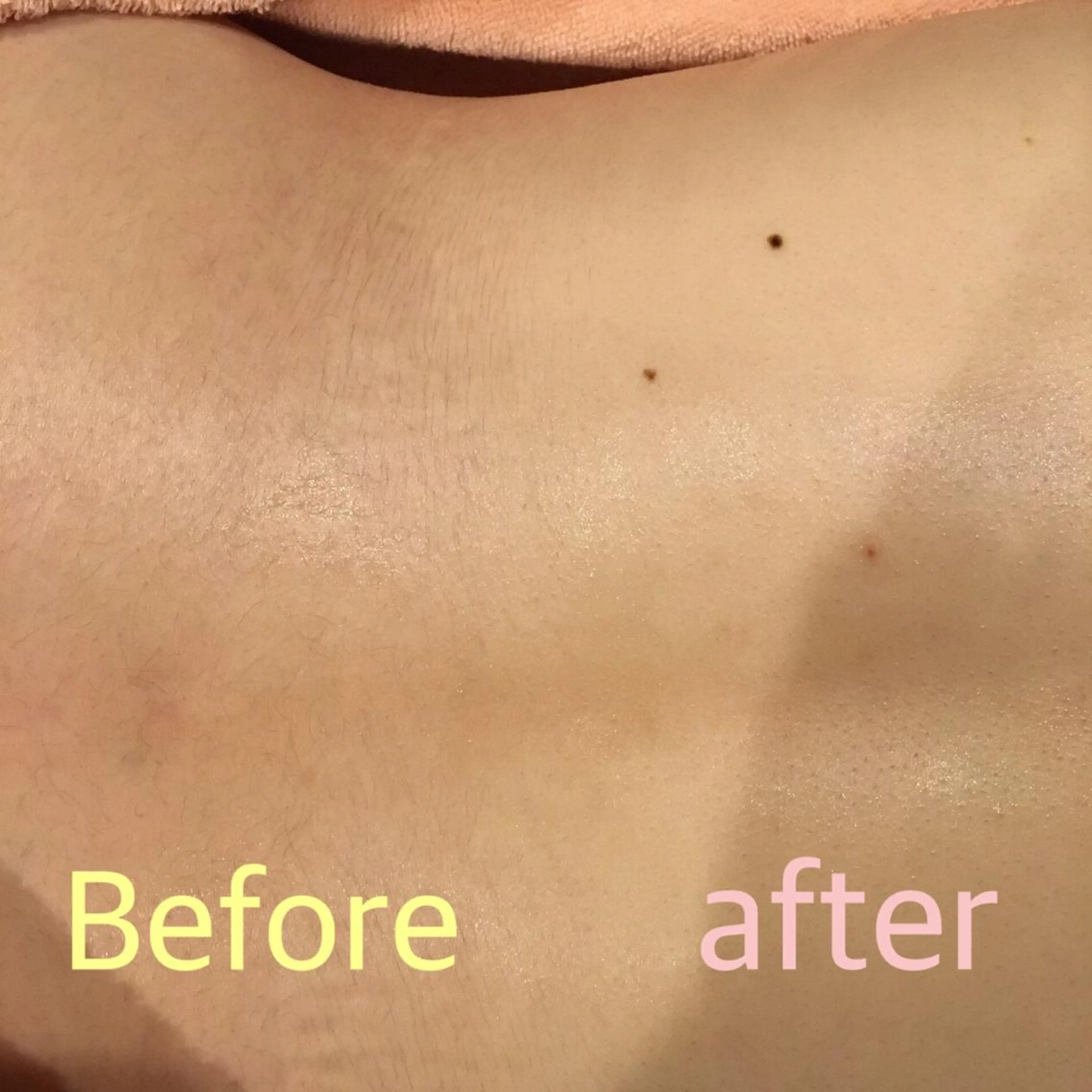 脱毛 美肌脱毛専門店 ディオーネ四日市店のエステ・リラクイメージ