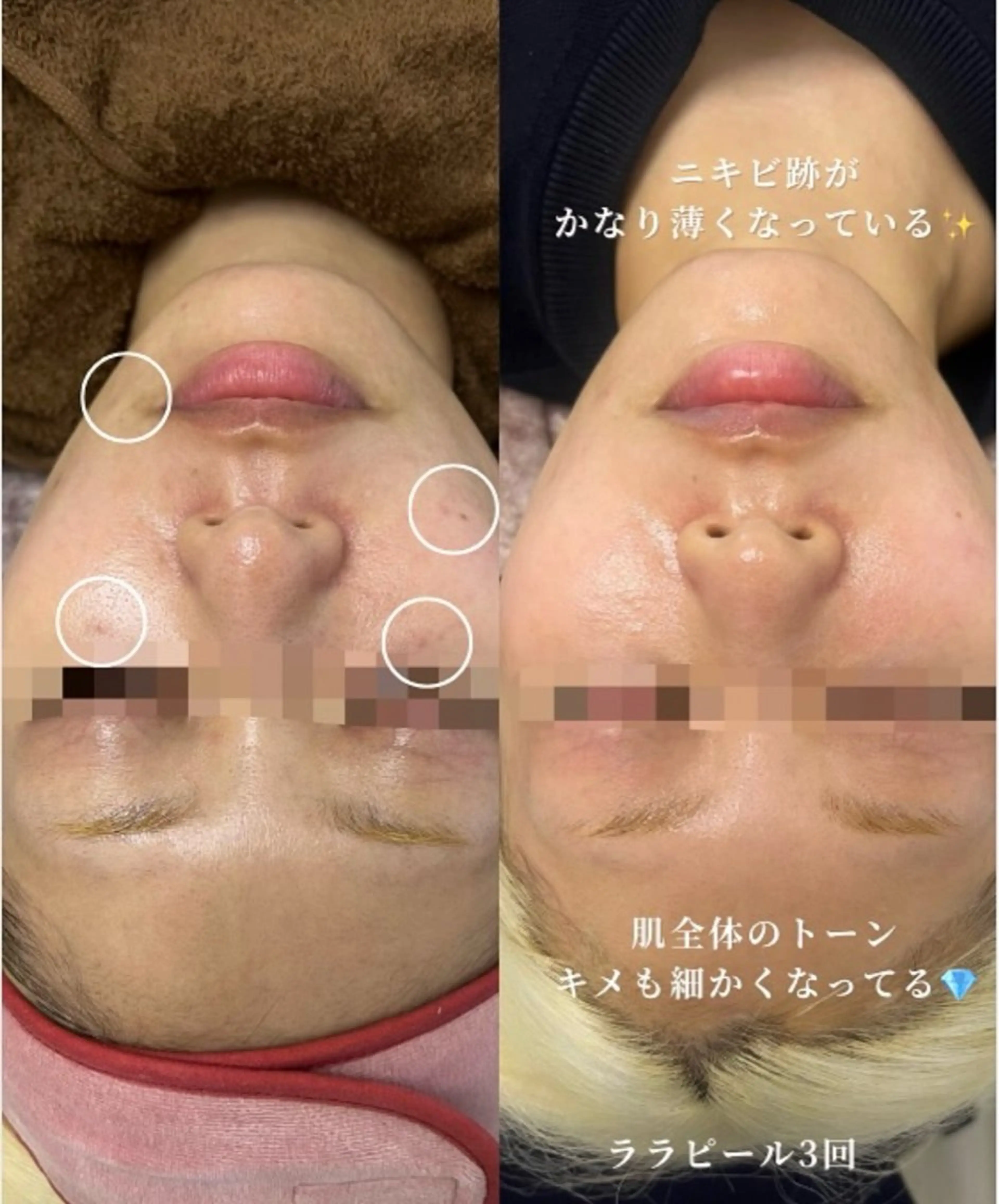 Nsが施術するサロン ナスサロ /Yuriのエステ・リラクイメージ