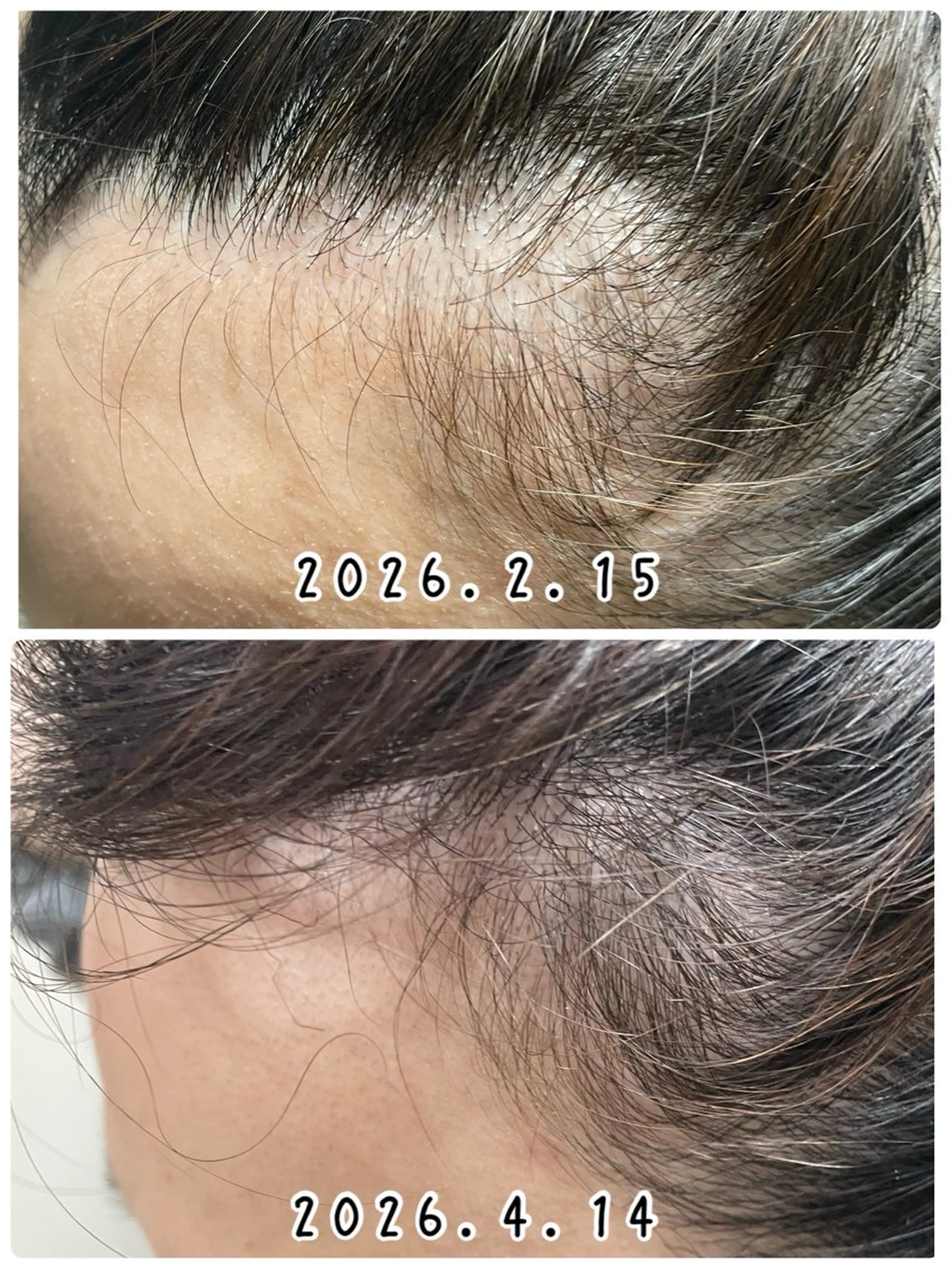 メンズ キッズ 美肌脱毛エステサロン Luangeのエステ・リラクイメージ