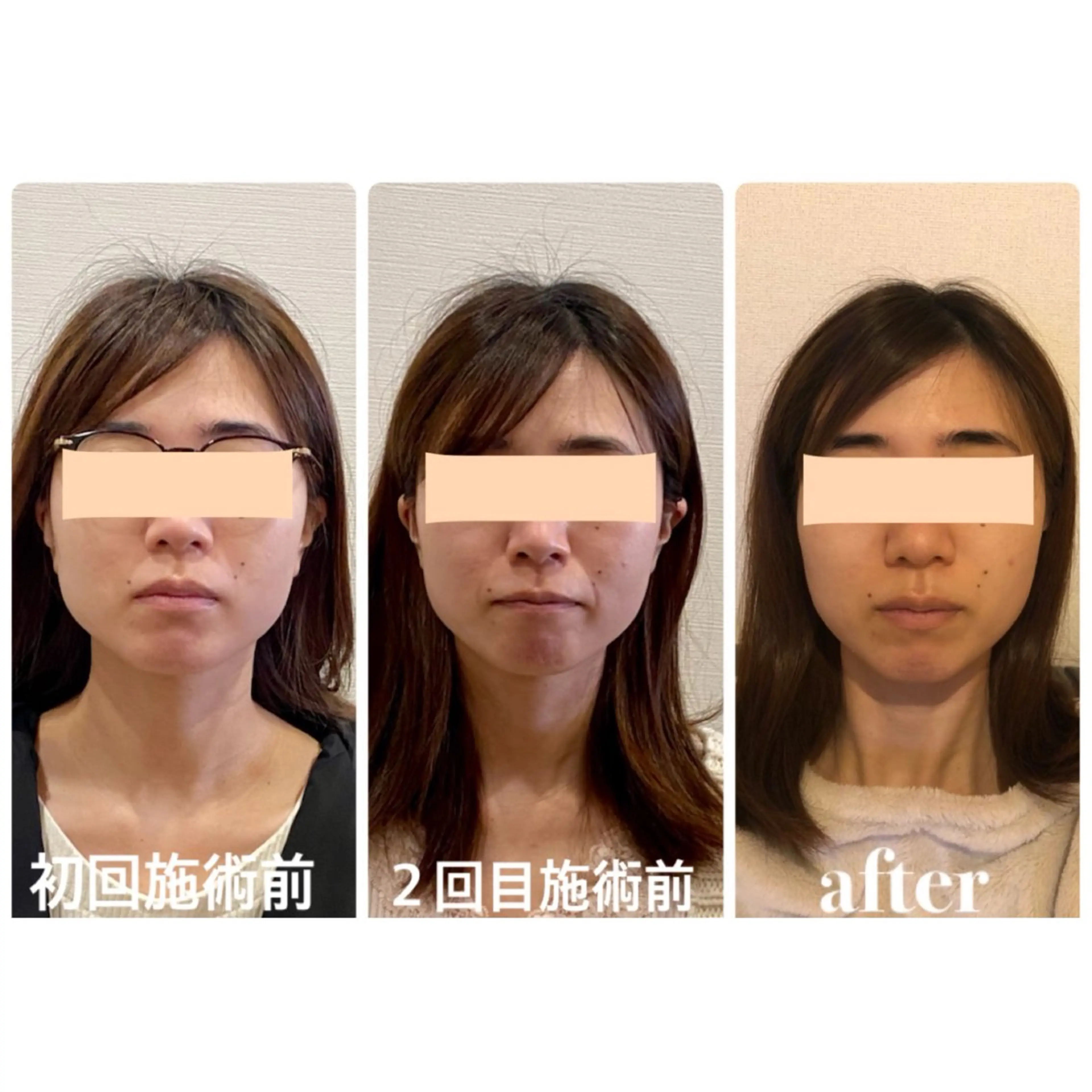 Cream 福井のエステ・リラクイメージ