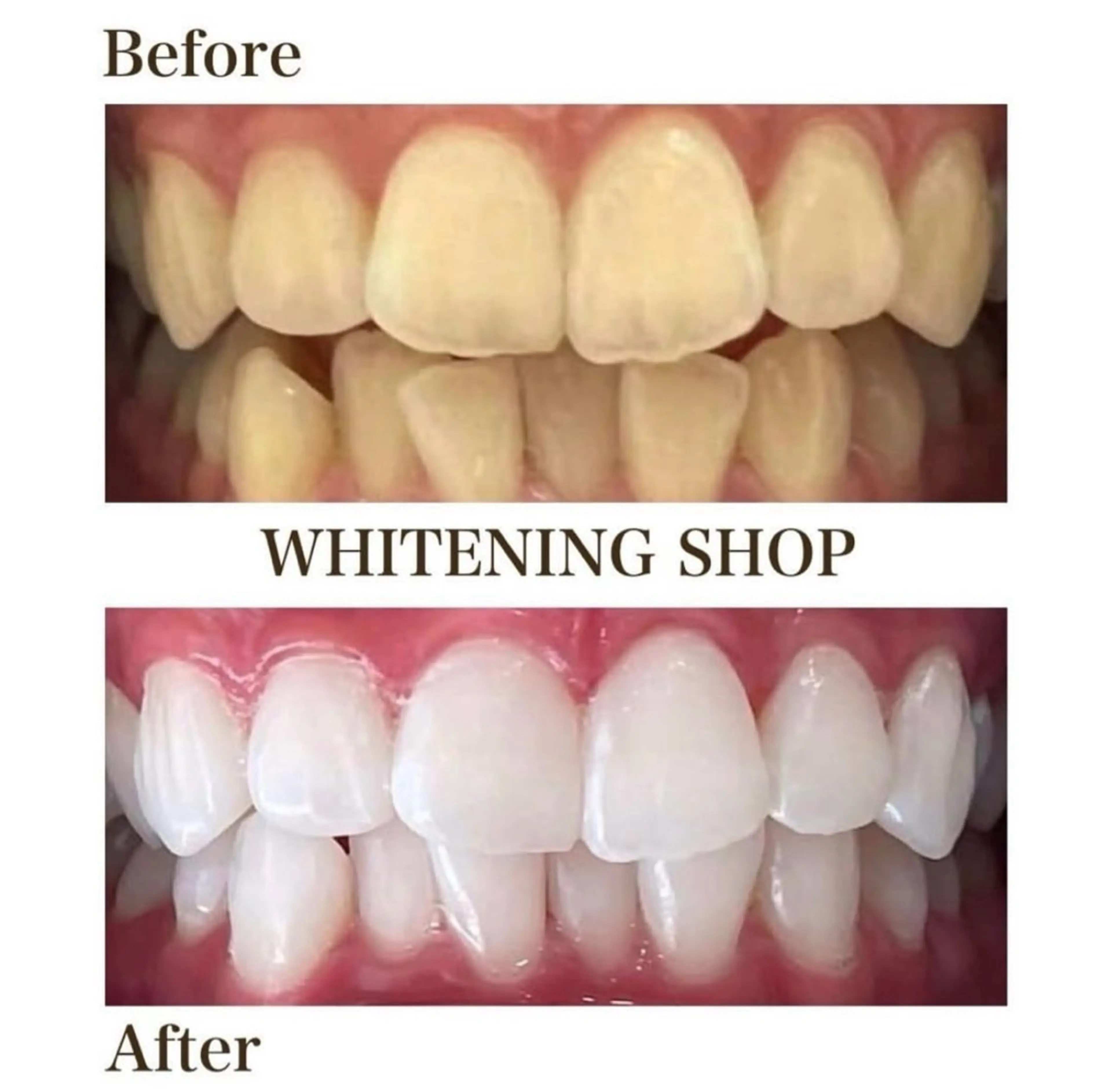 ホワイトニング ショップ伊丹店のその他イメージ