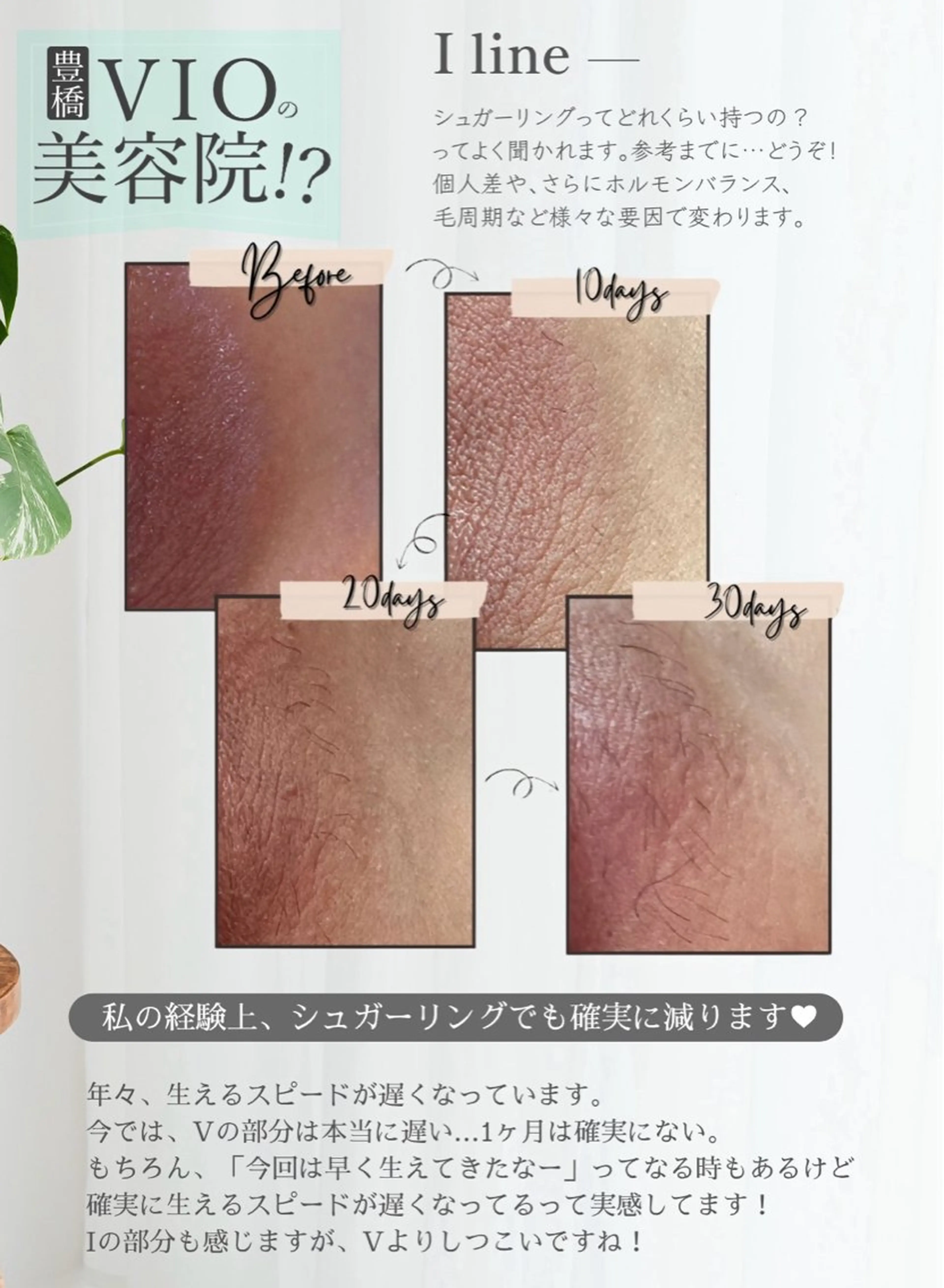 Hitomi シュガーリング豊橋のその他イメージ