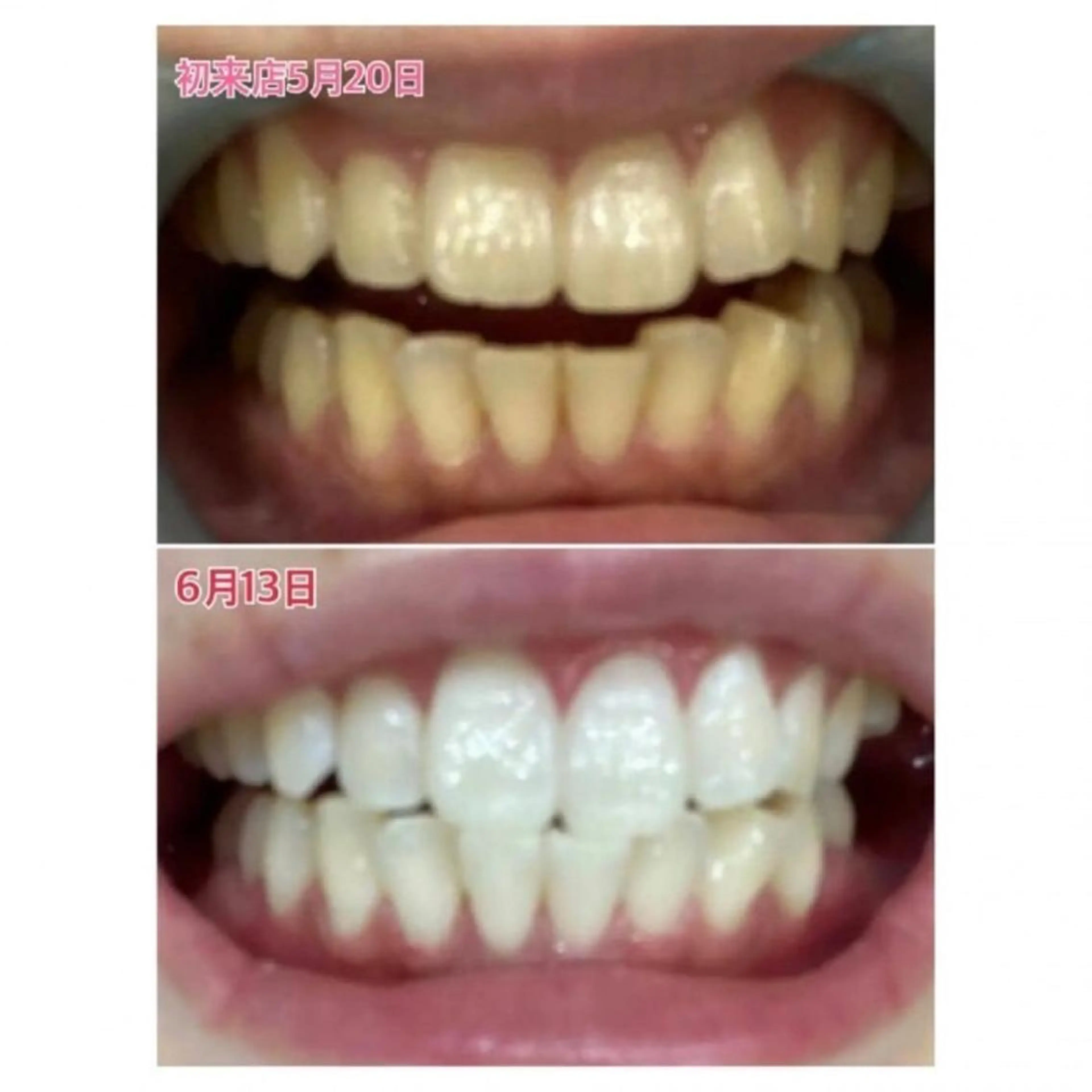 M渋谷 ホワイトニングのエステ・リラクイメージ