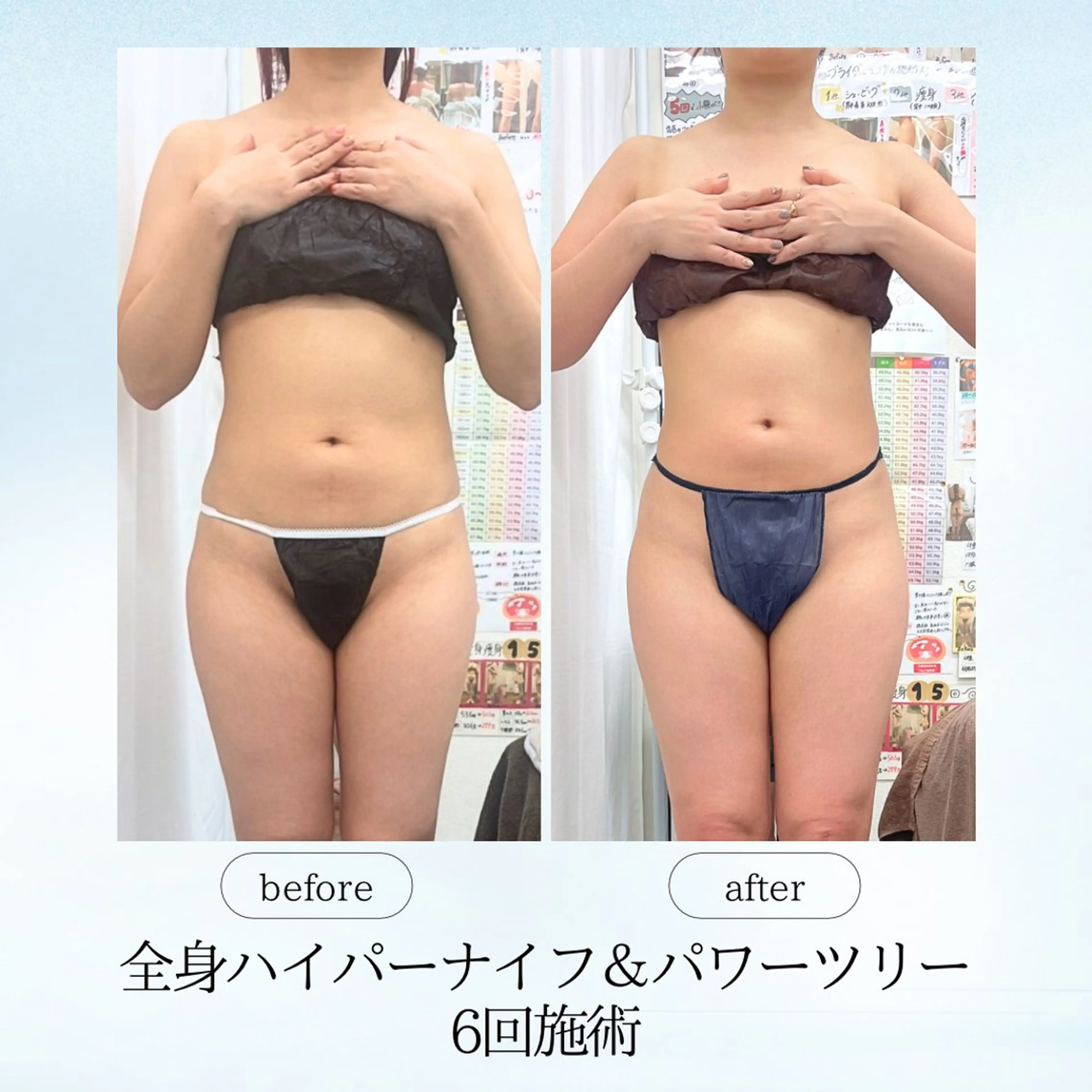 エステ リラク espresso,所属・《痩身、小顔専門店》 エスプレッソのエステ・リラクイメージ