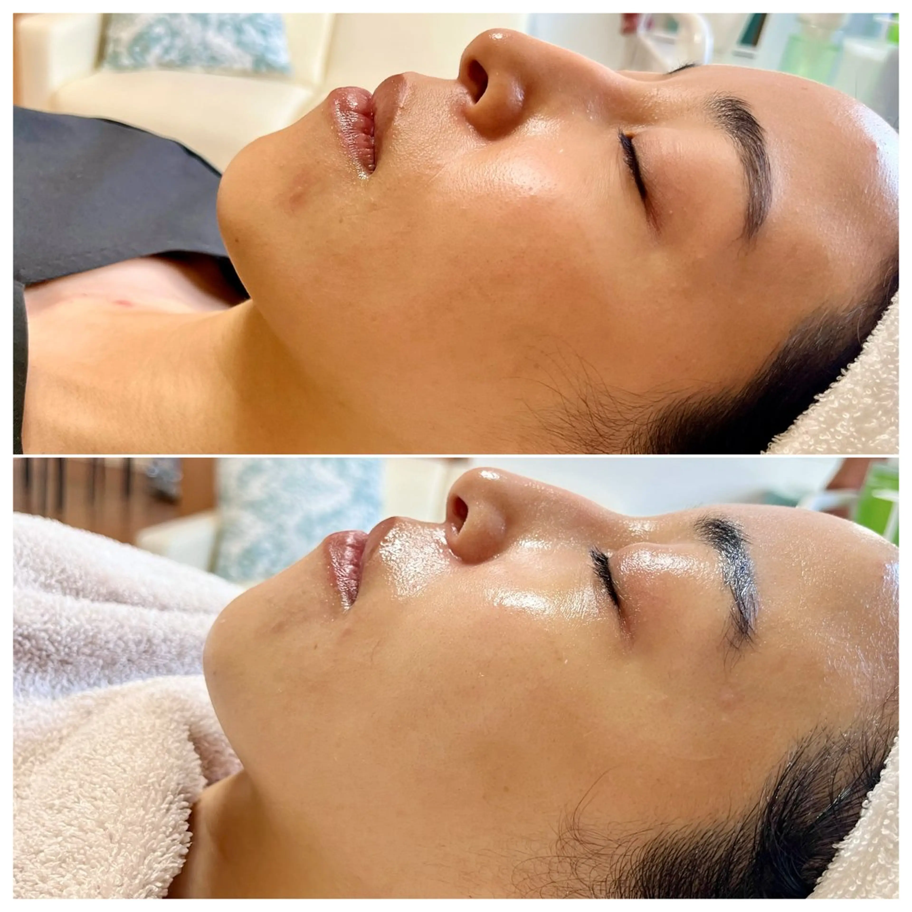 エステ リラク La Dusa 韓国肌管理/小波のエステ・リラクイメージ