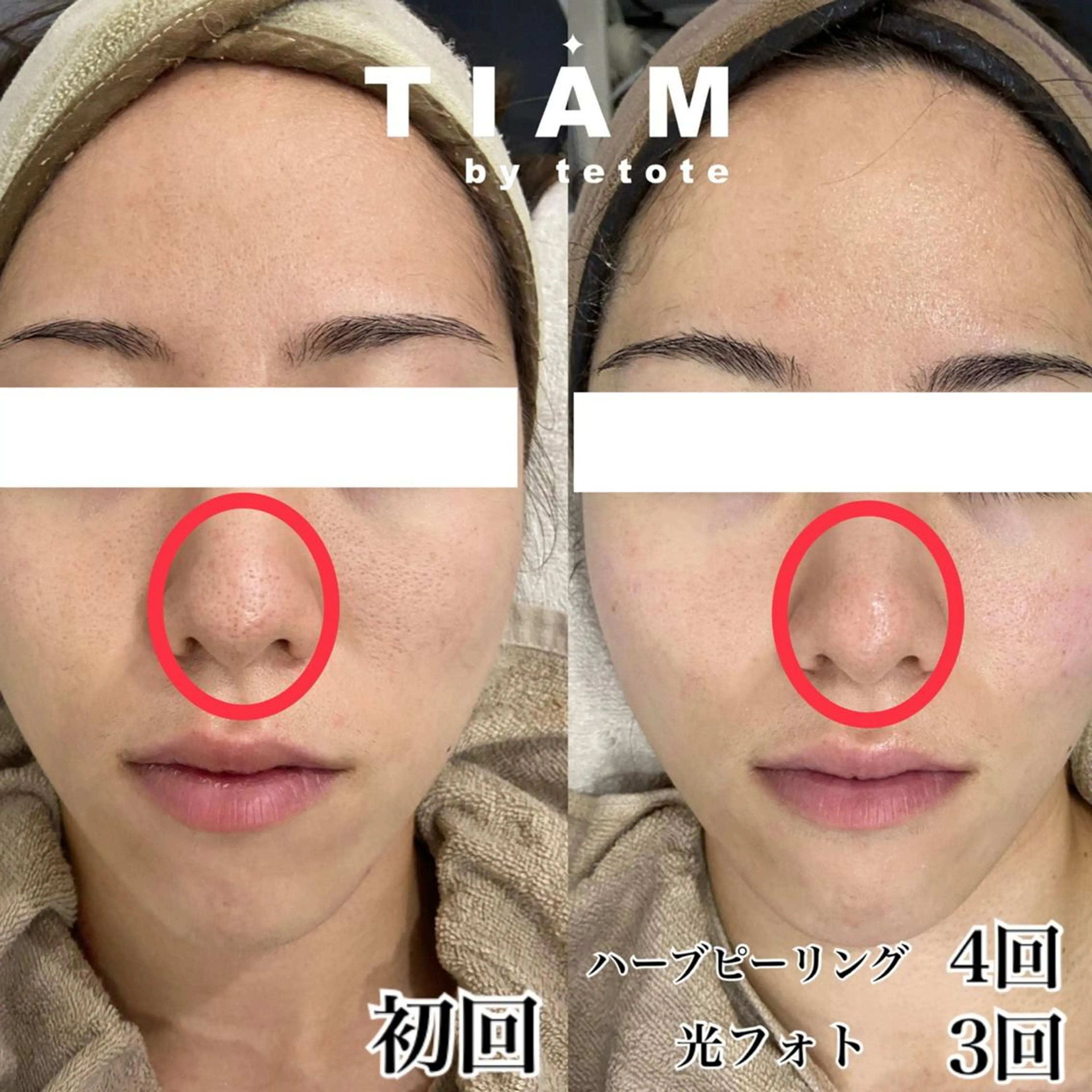 エステ 美肌サロンTIAM by tetoteのエステ・リラクイメージ