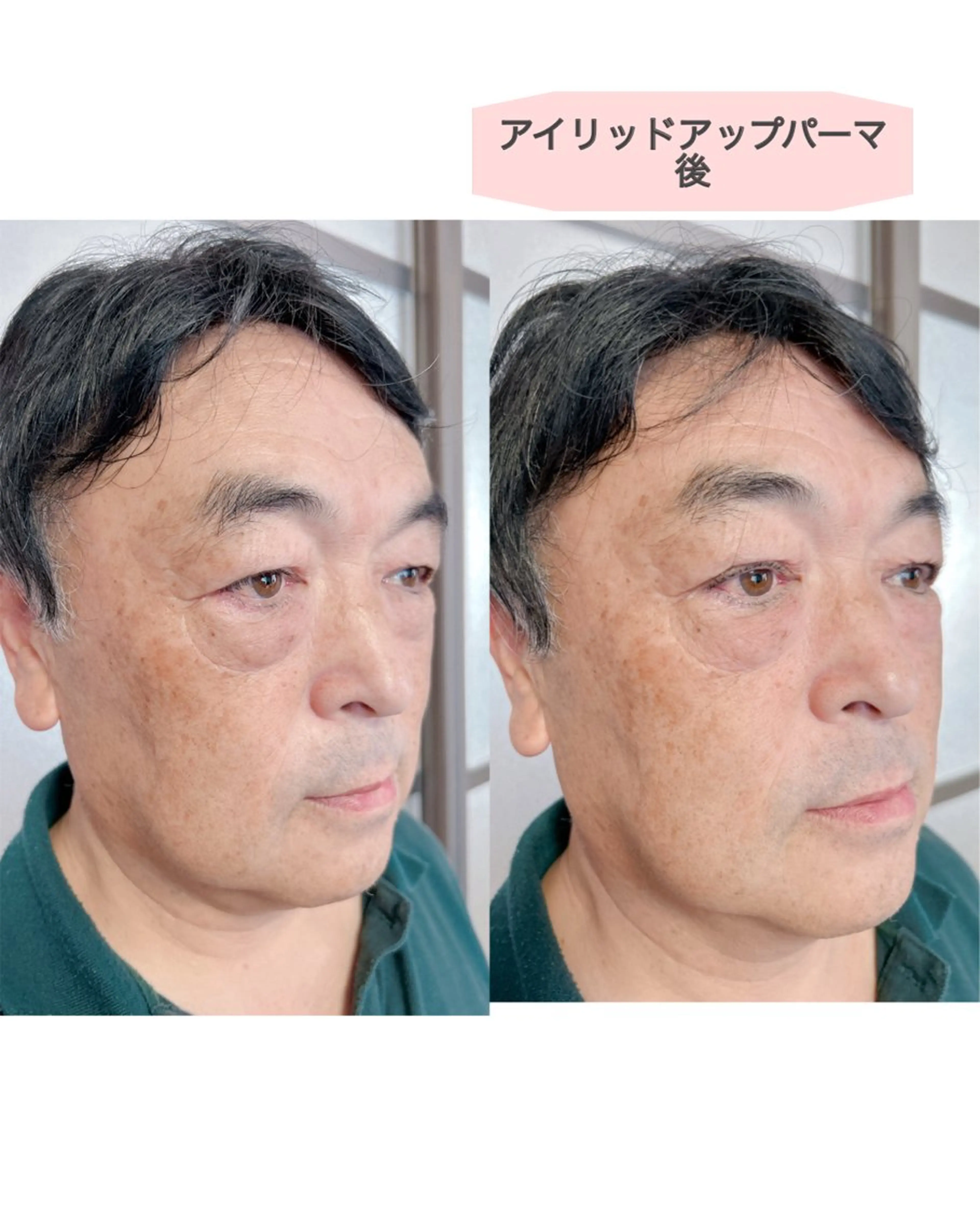 限定⭕️メンズ専用👀アイリッドアップパーマ✨瞼はすっきりしたいけれどまつ毛は上げすぎたくない方🔮の写真