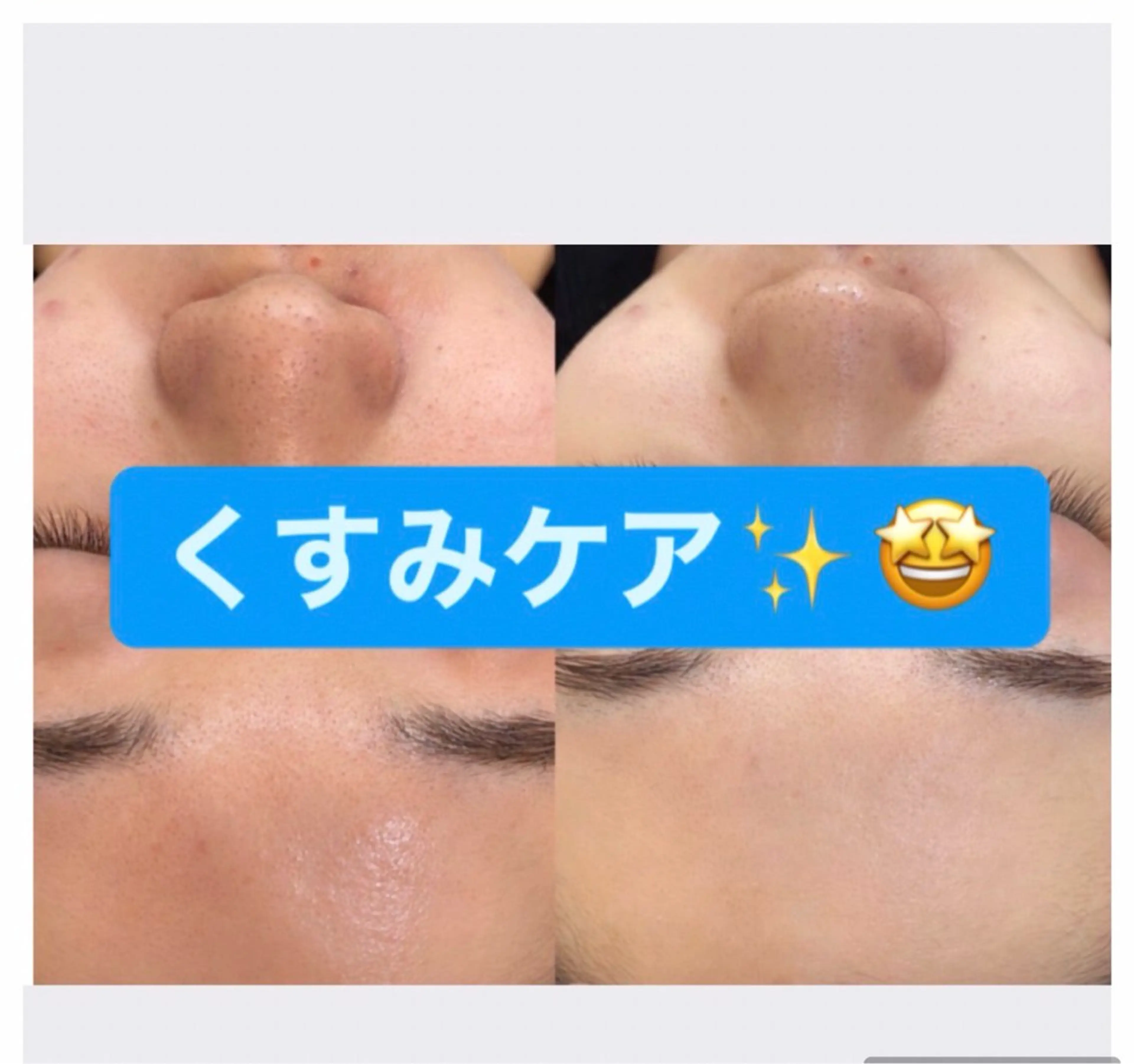 トータルサロンWAC 黒野のエステ・リラクイメージ