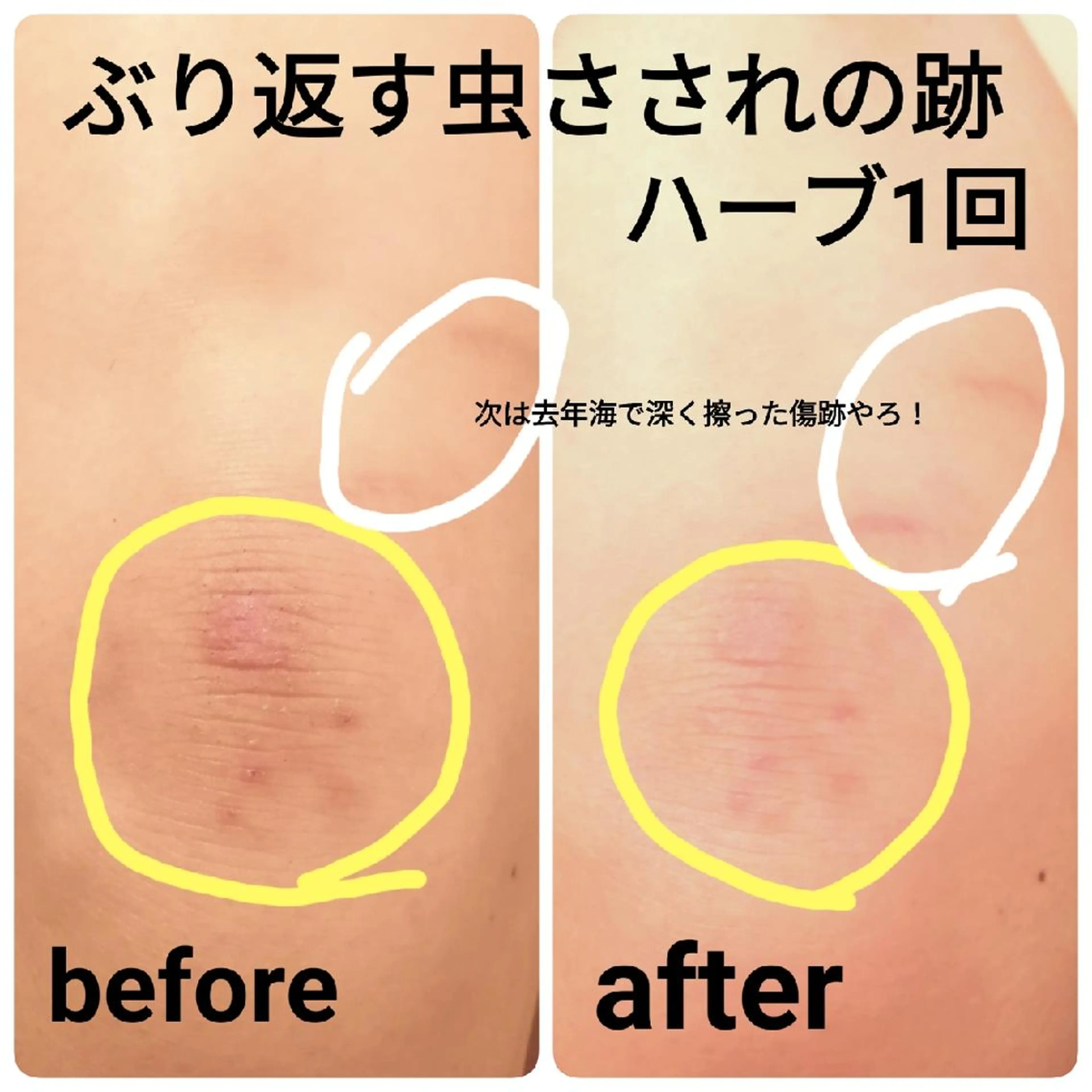 未病ケアサロン　EMINY所属・未病ケアサロン EMINY☺︎勝俣のエステ・リラクイメージ