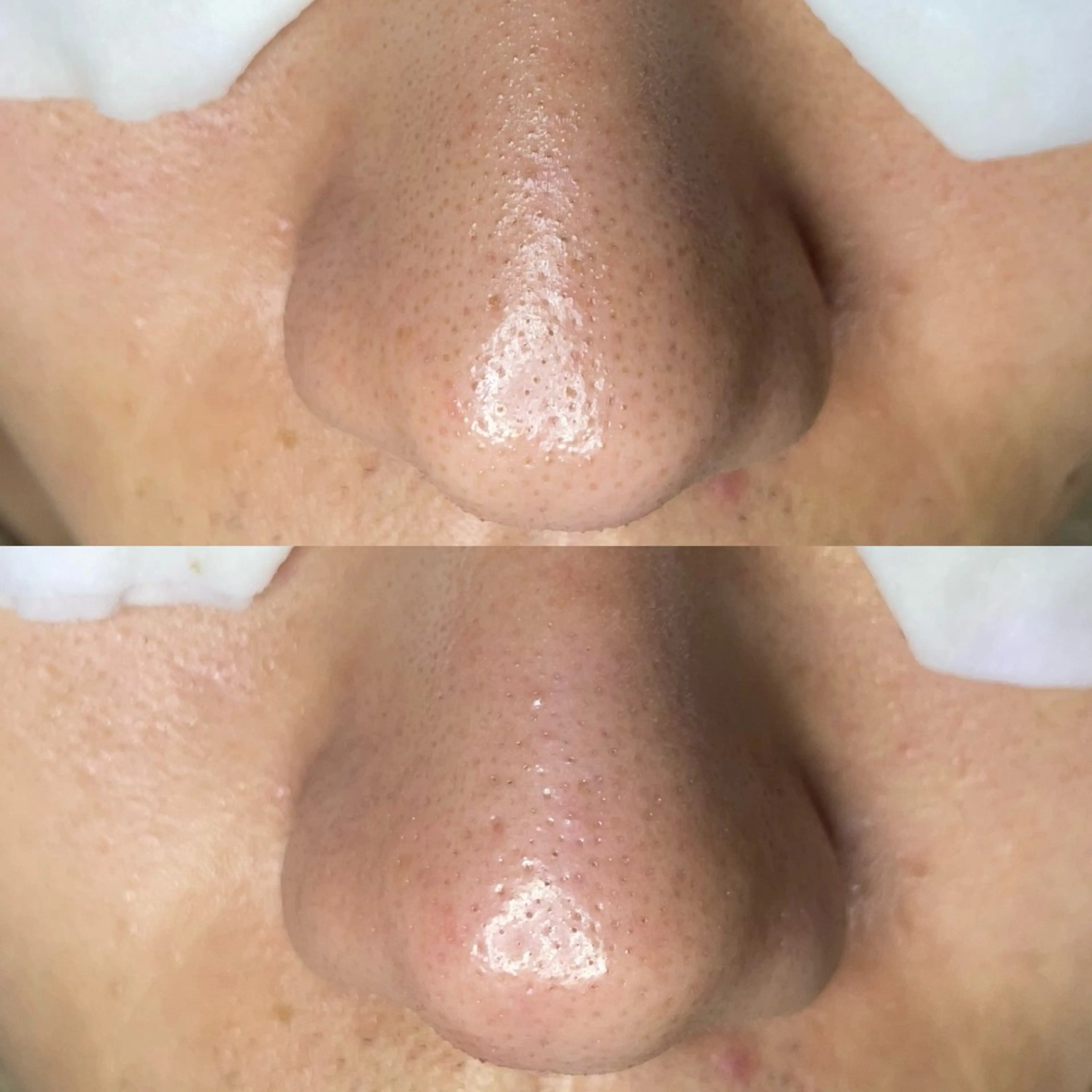 エステ Re:Belle 久留米 : 中島のエステ・リラクイメージ