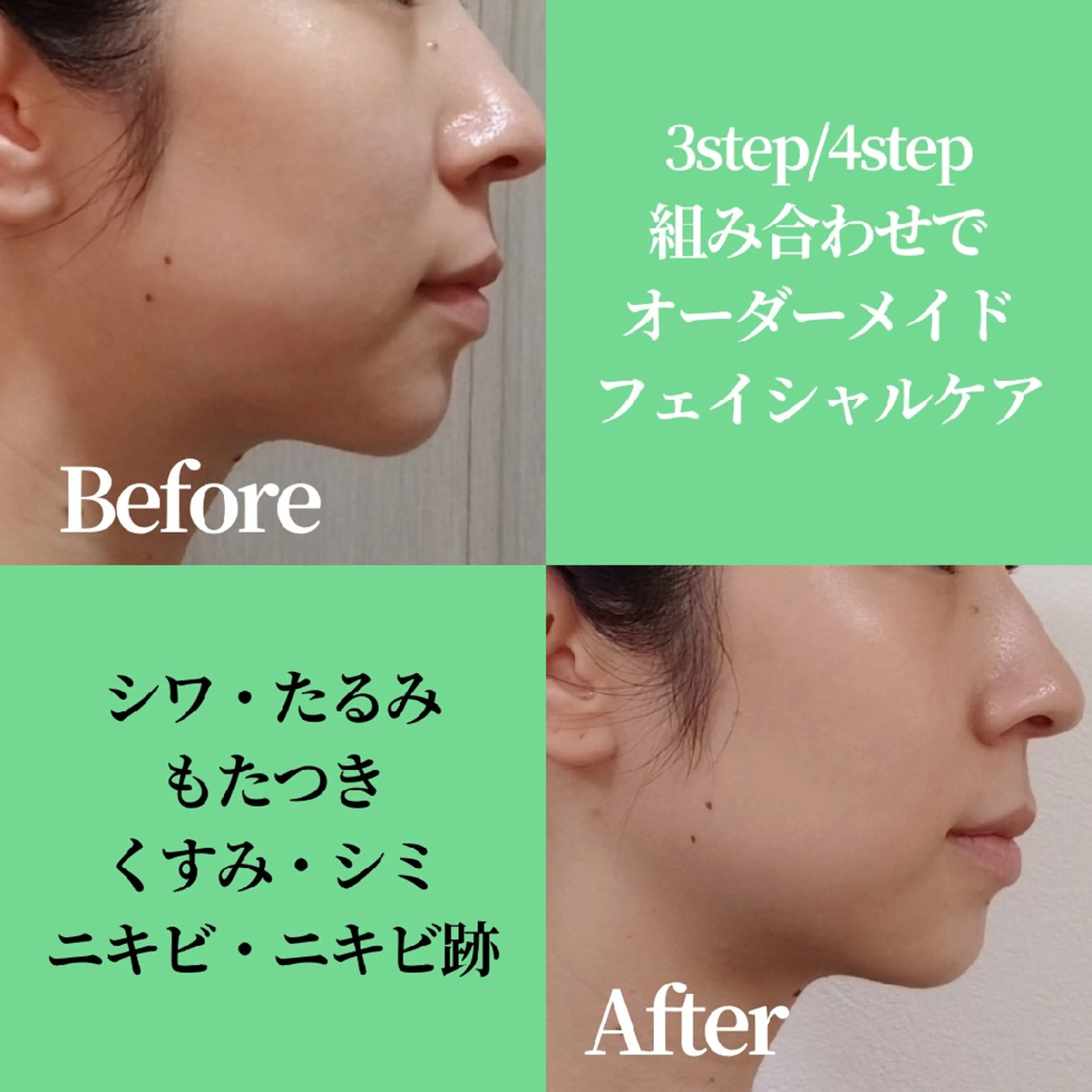 エステ リラク ICHOOSE/ 代々木上原のエステ・リラクイメージ