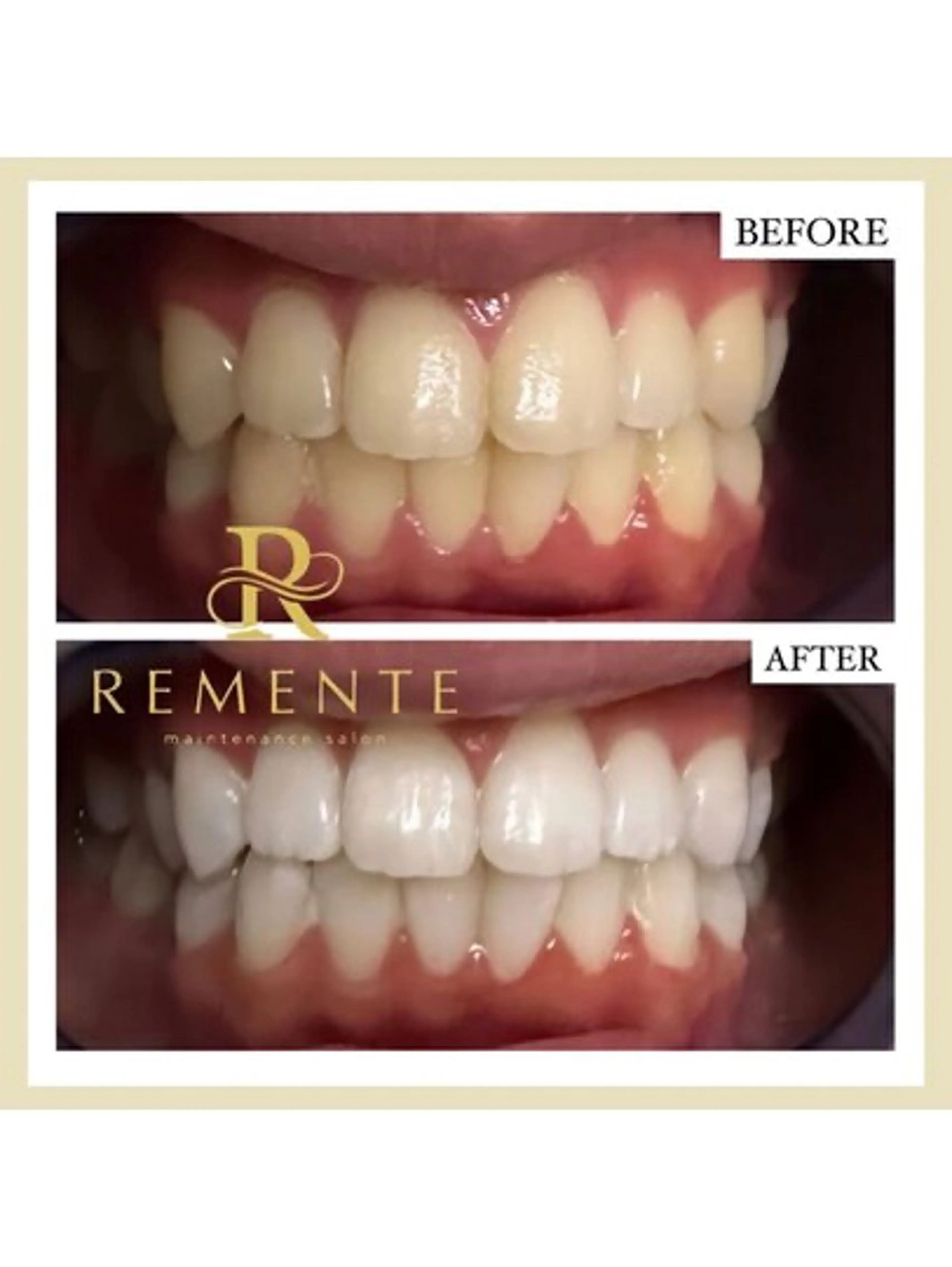 その他 美養HAREHADA 🫧/ Ibukiの眉毛・アイブロウイメージ