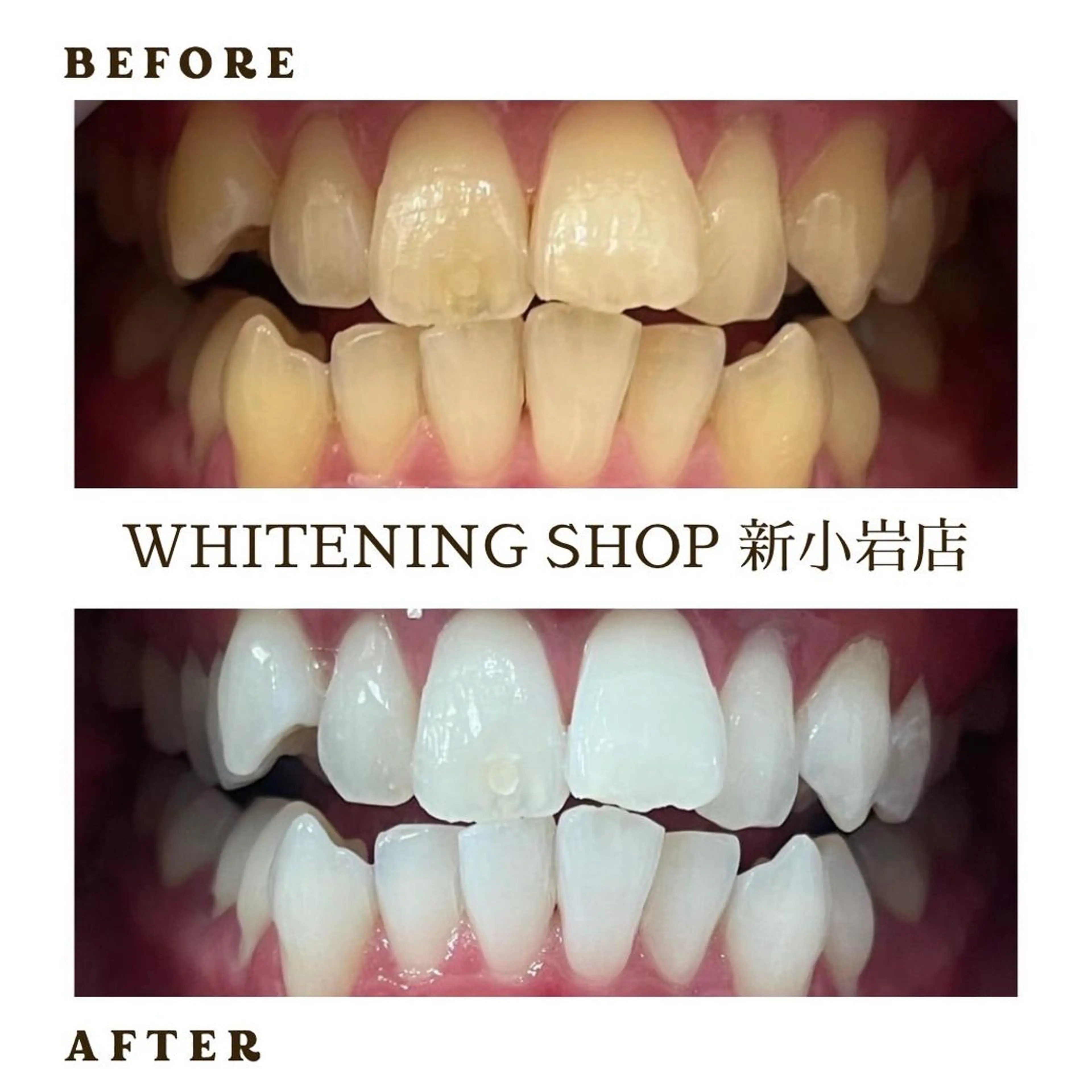 メンズ その他 ホワイトニング ショップ新小岩店のその他イメージ