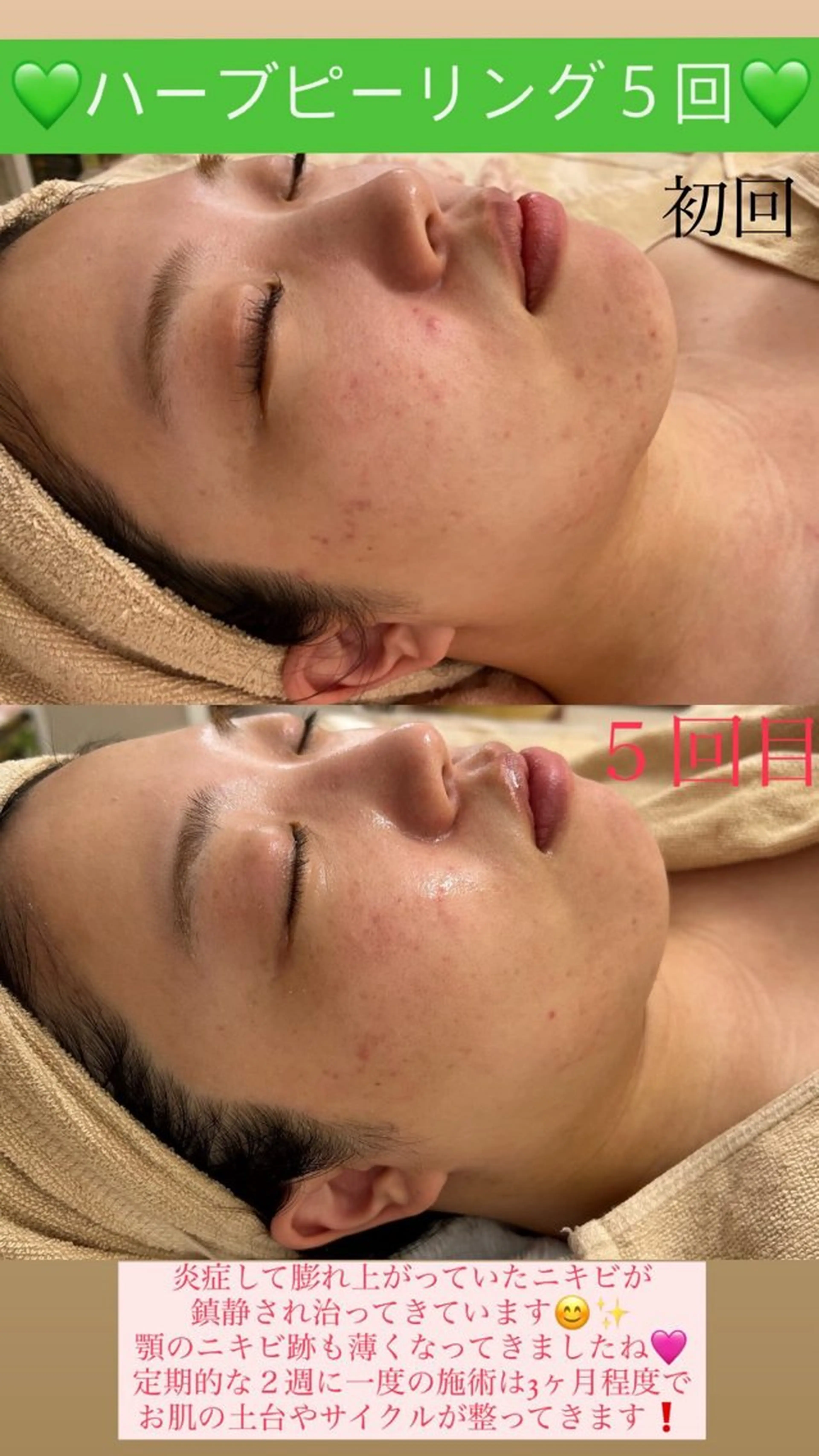 メンズ エステ Salon de Lino 御器所のエステ・リラクイメージ