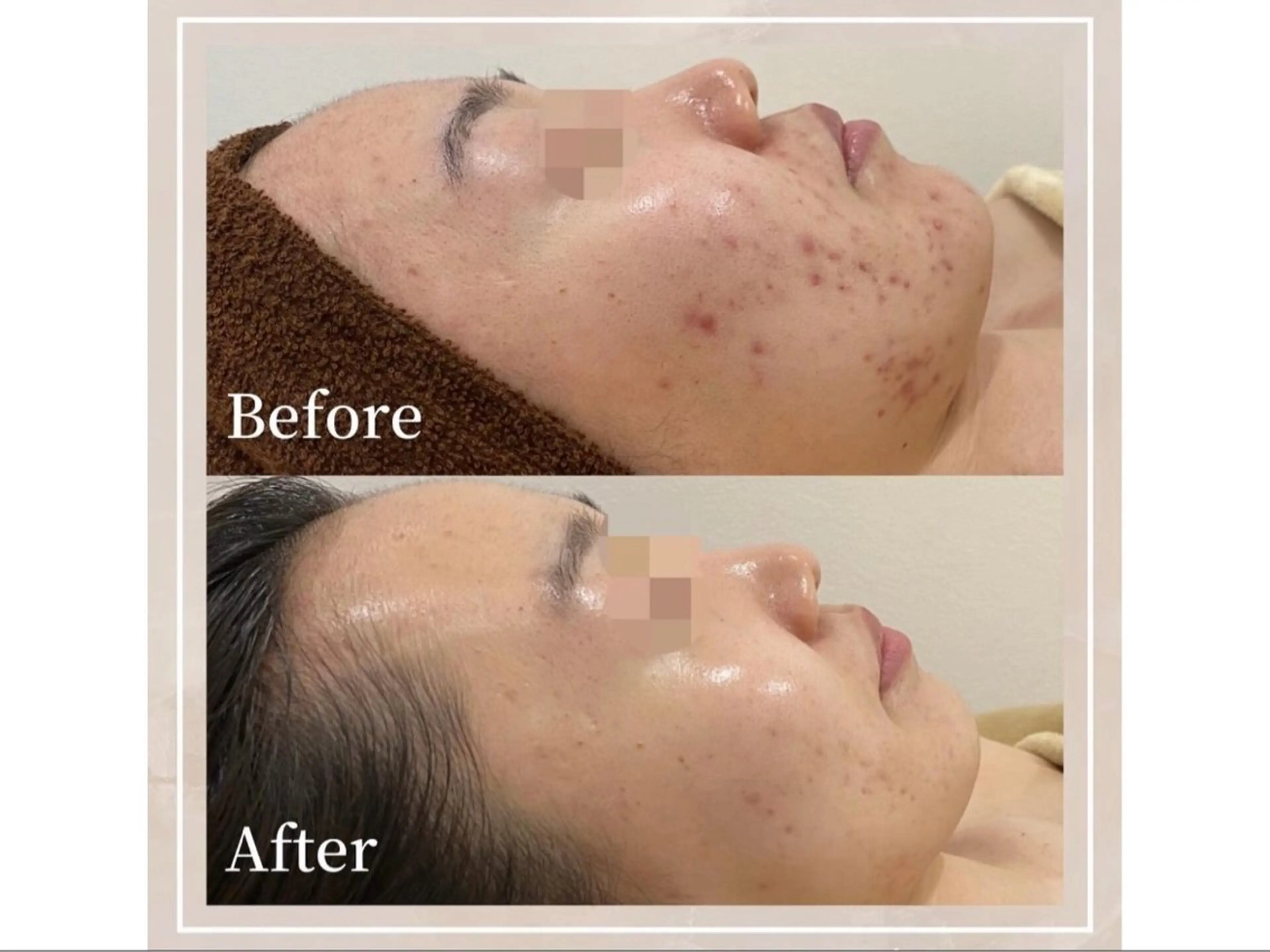 chou cherie所属・🌈肌質改善サロン. manami🌈のエステ・リラクイメージ