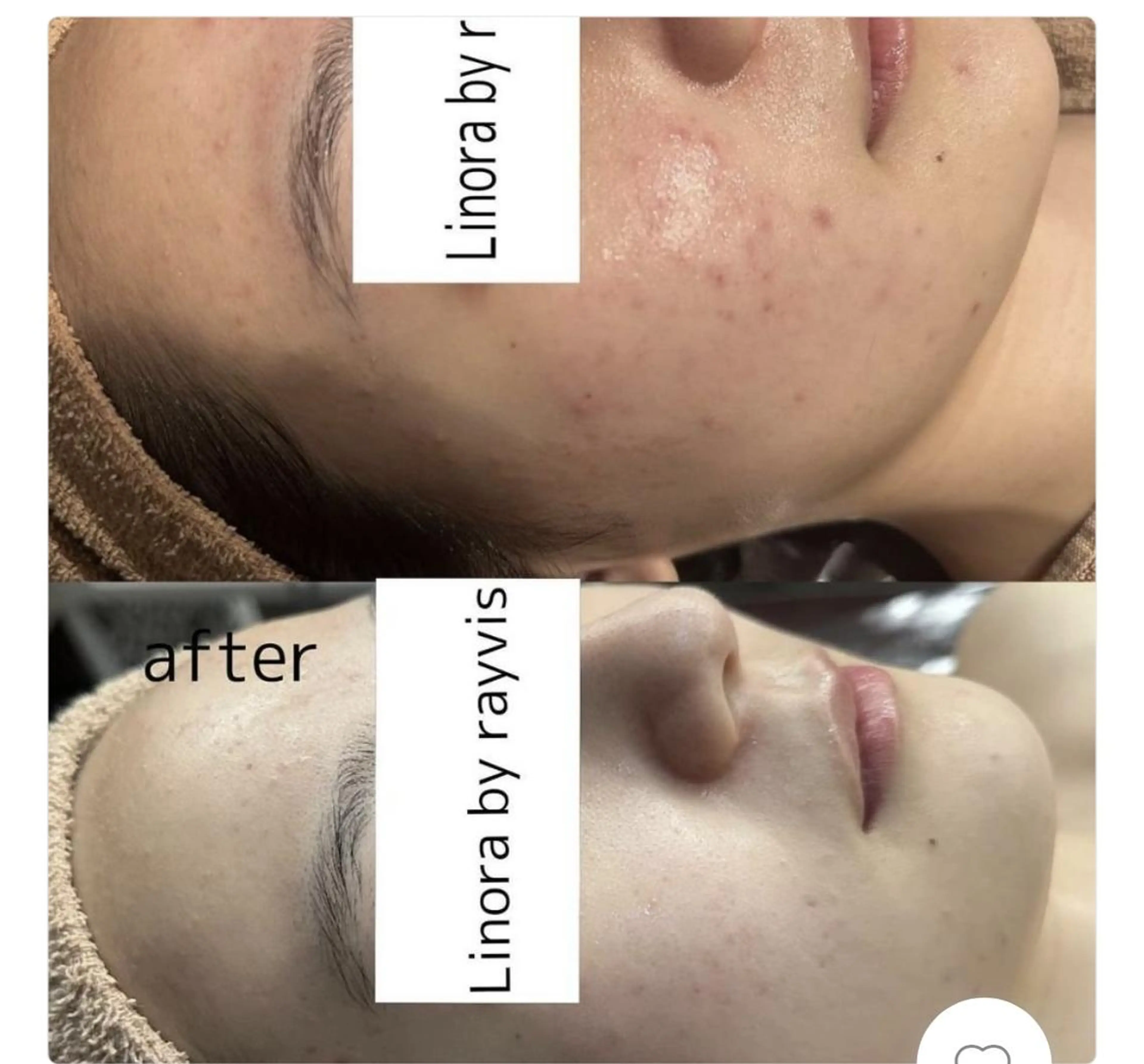 👑Linola👑 レイビス　纐纈のエステ・リラクイメージ