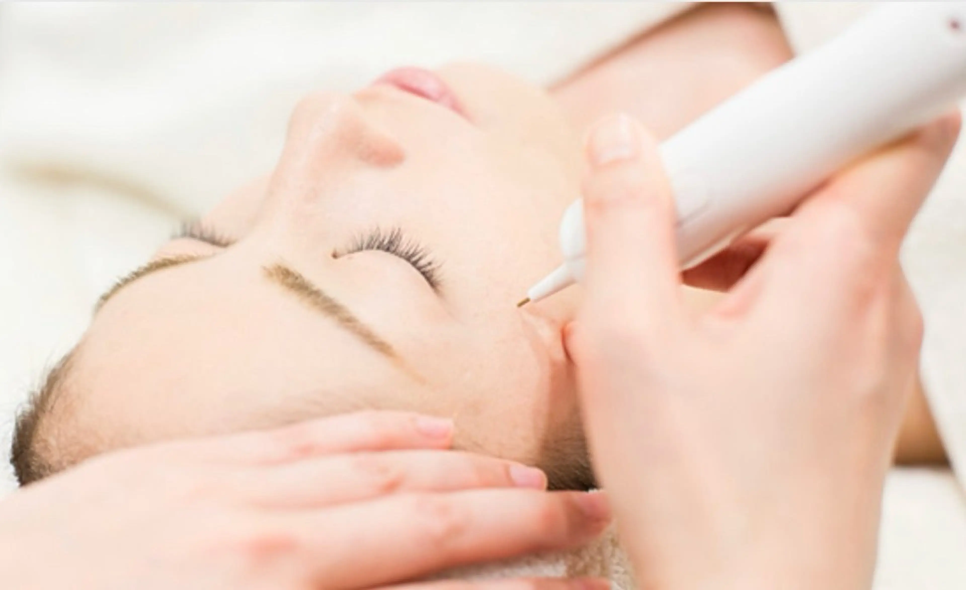 『ポイントシミケア5分』ハーフピーリング➕高濃度炭酸ヘッドマッサージ付きの写真