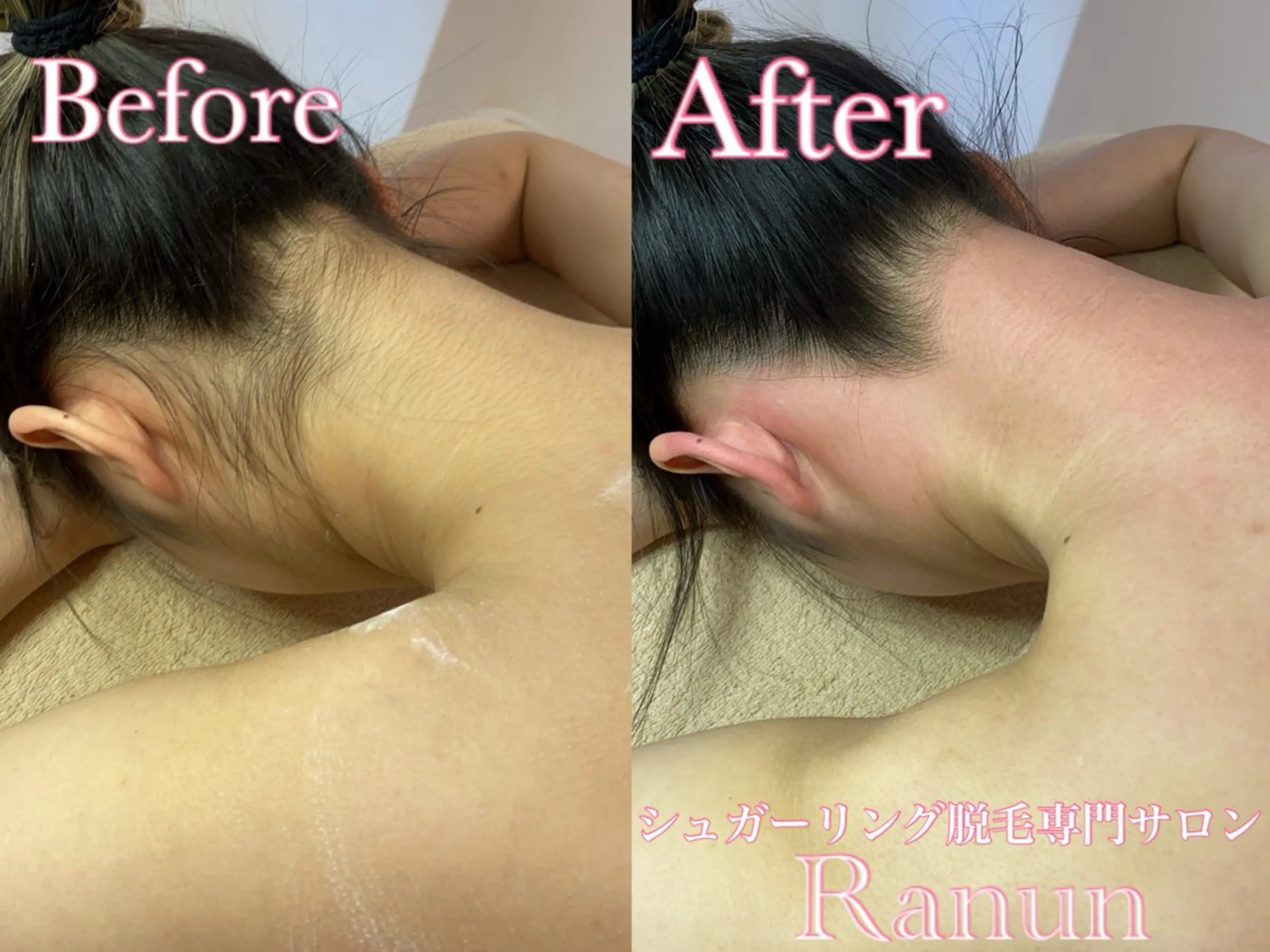 マツエク・マツパ 脱毛 シュガーリング脱毛 専門店Ranunのエステ・リラクイメージ