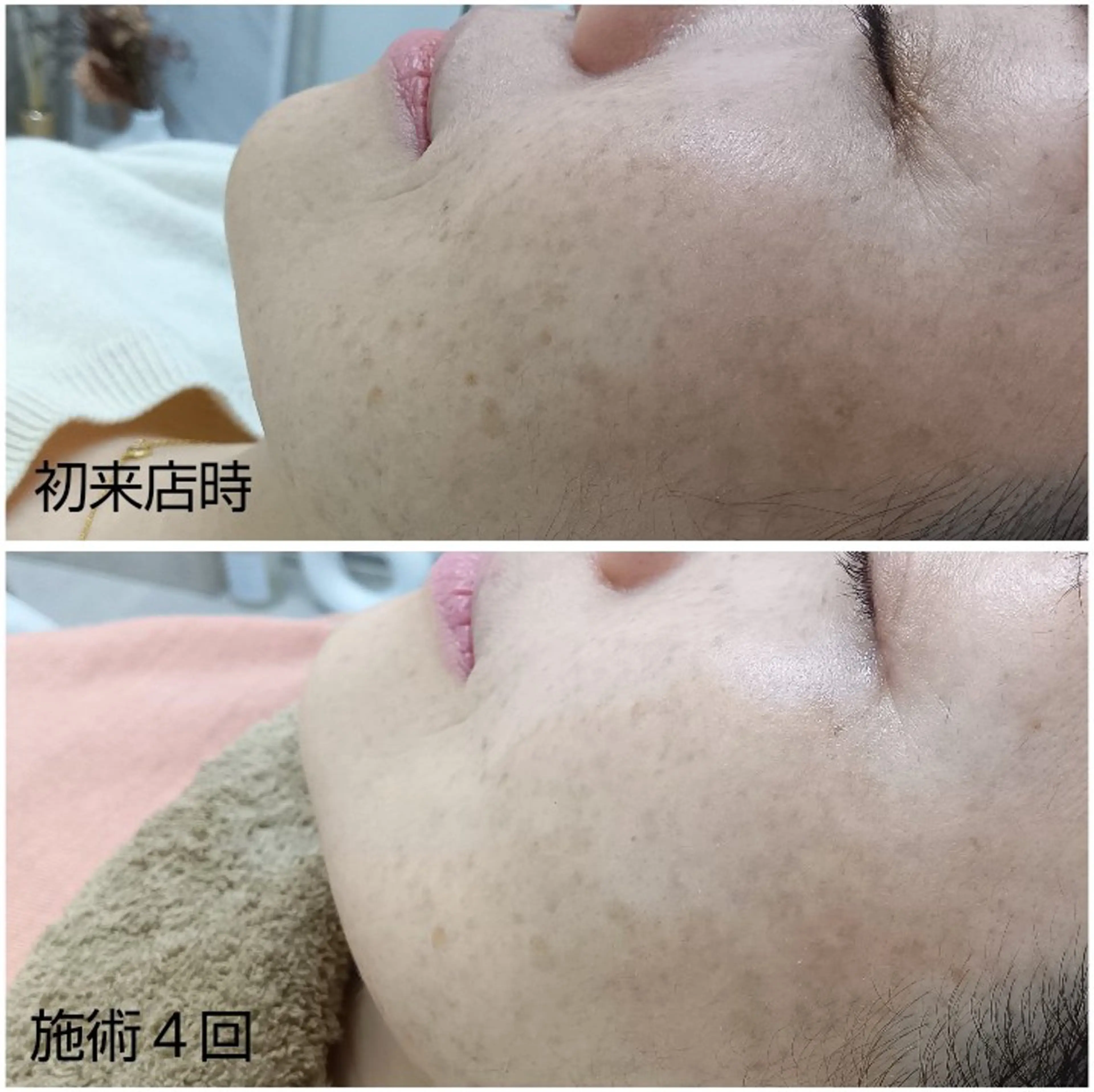 シミケア専門店 HAQUAのエステ・リラクイメージ