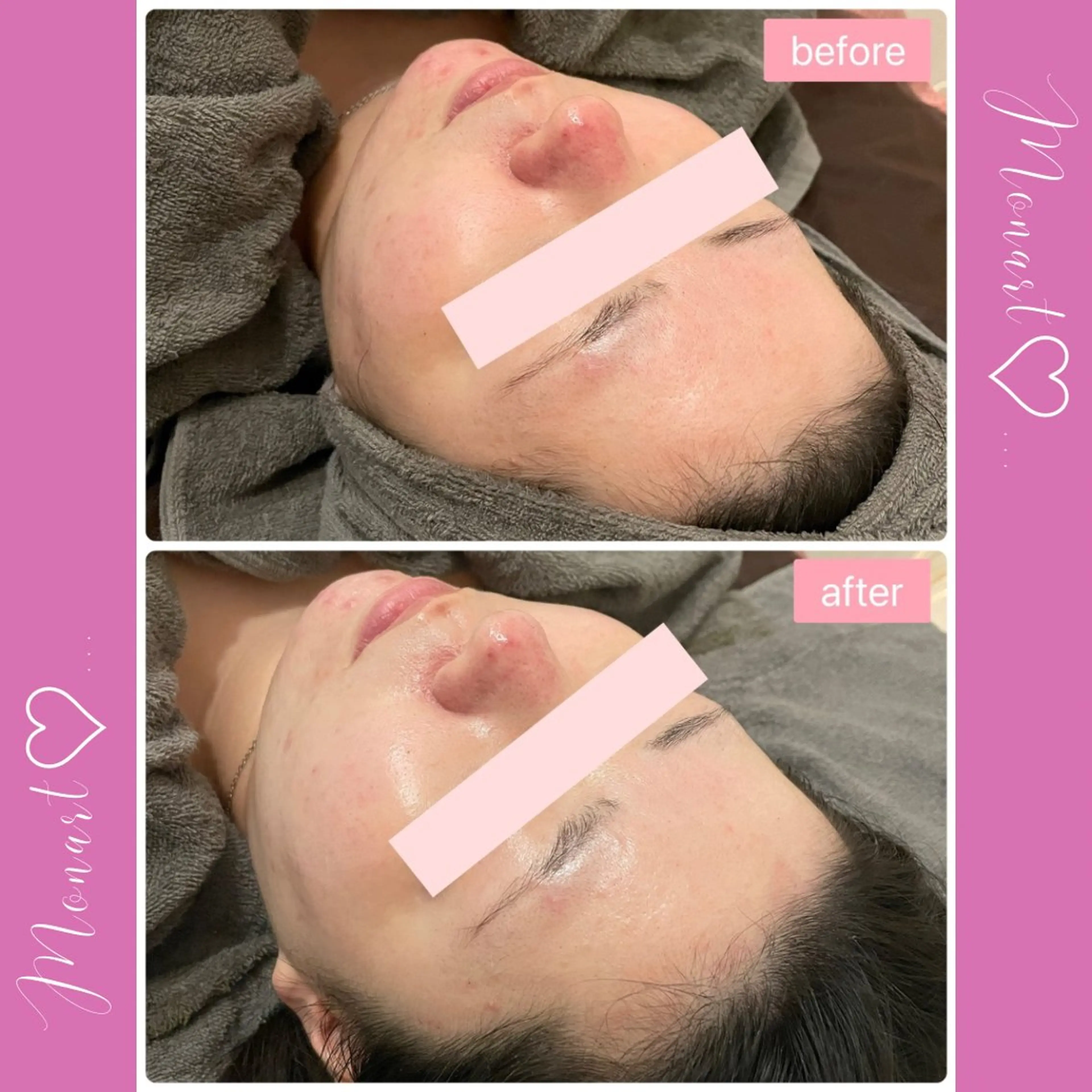 Monart -deux-のエステ・リラクイメージ