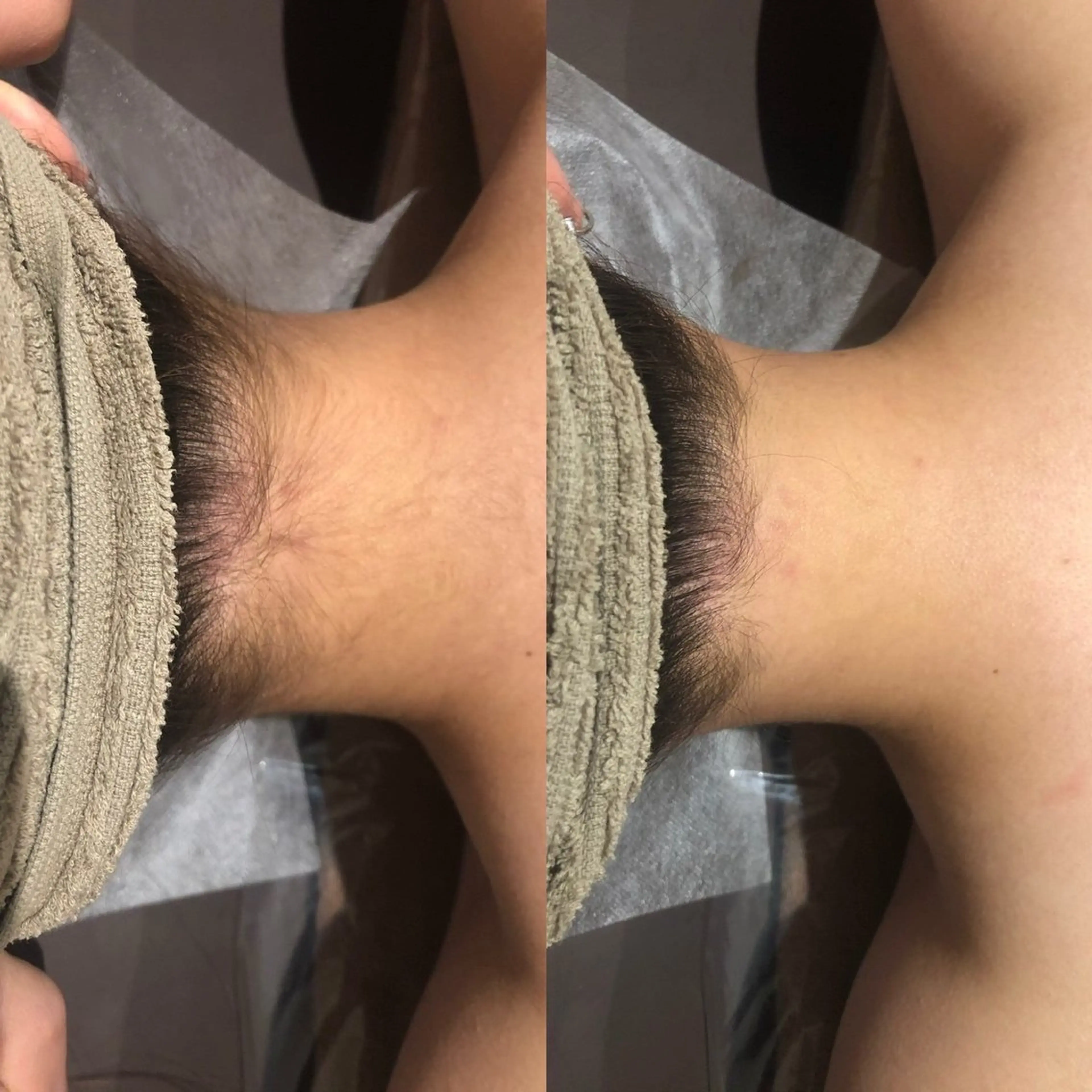 脱毛 folche博多 NAMIのエステ・リラクイメージ