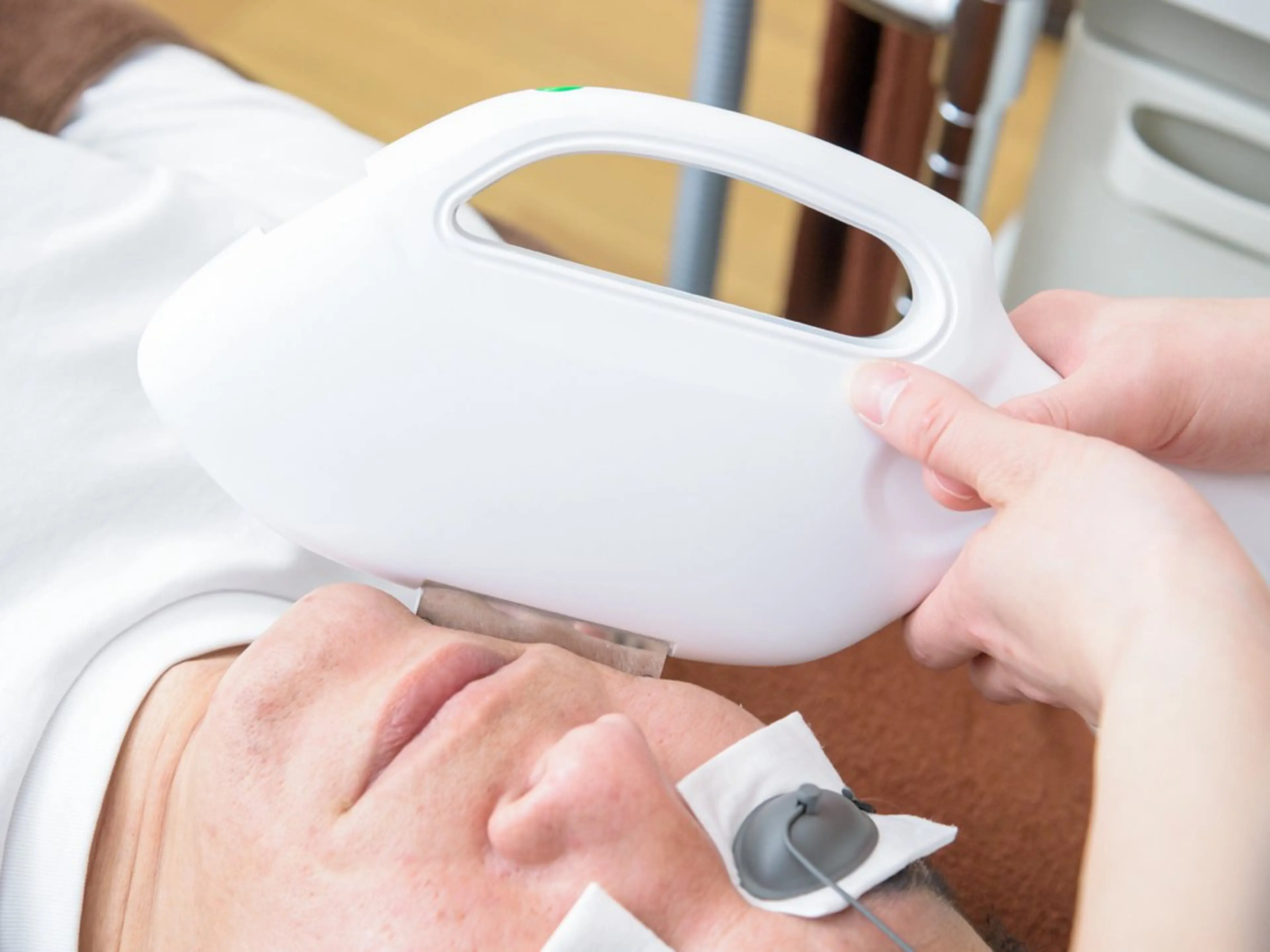 【初回】男性ひげ脱毛 ¥5500→¥3000の写真