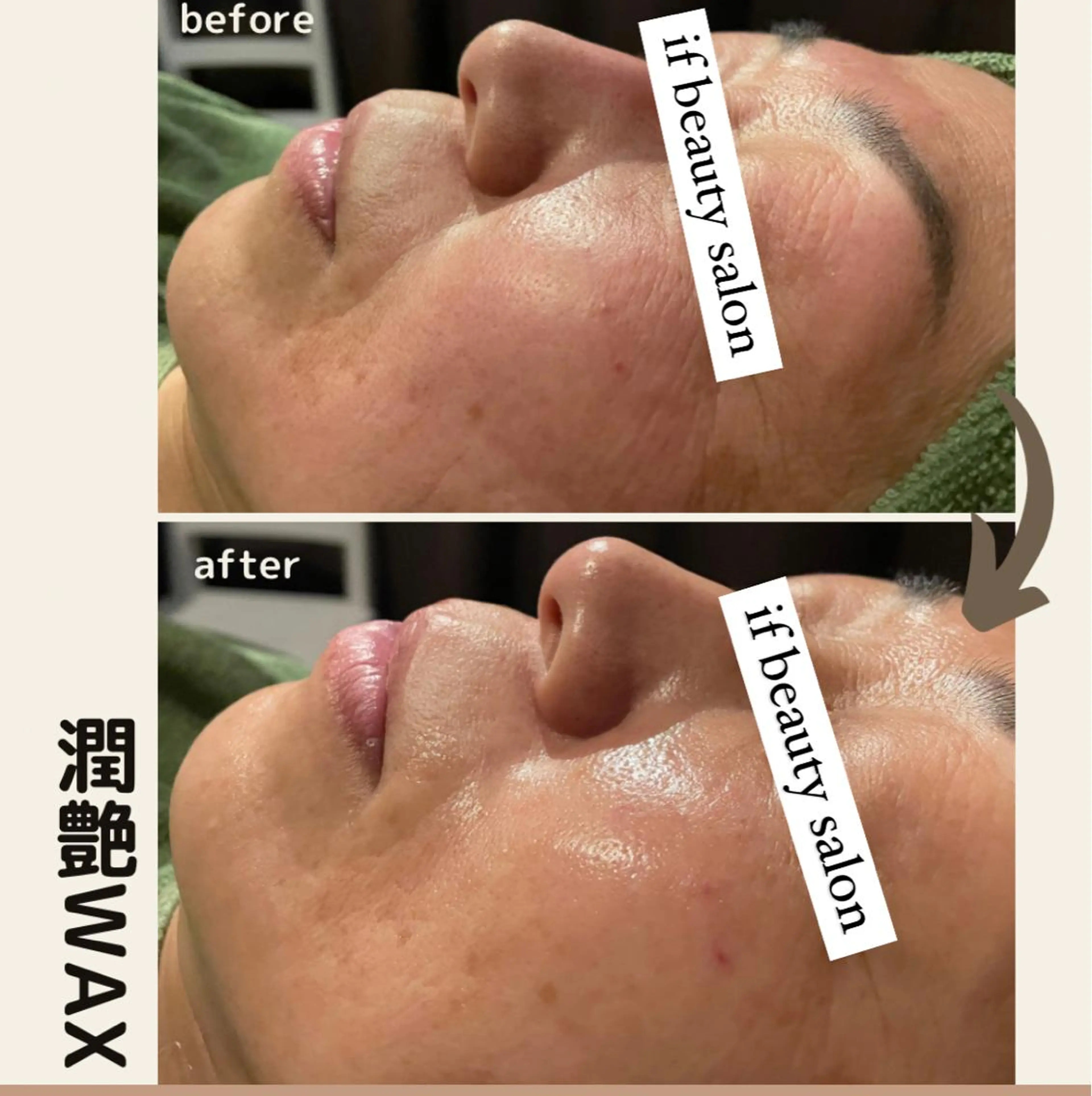 【毛穴・たるみ・くすみ・シワ解消究極の組み合わせ】潤艶WAX炭酸ガスパック仕上げ。ヘッドスパ付きの写真