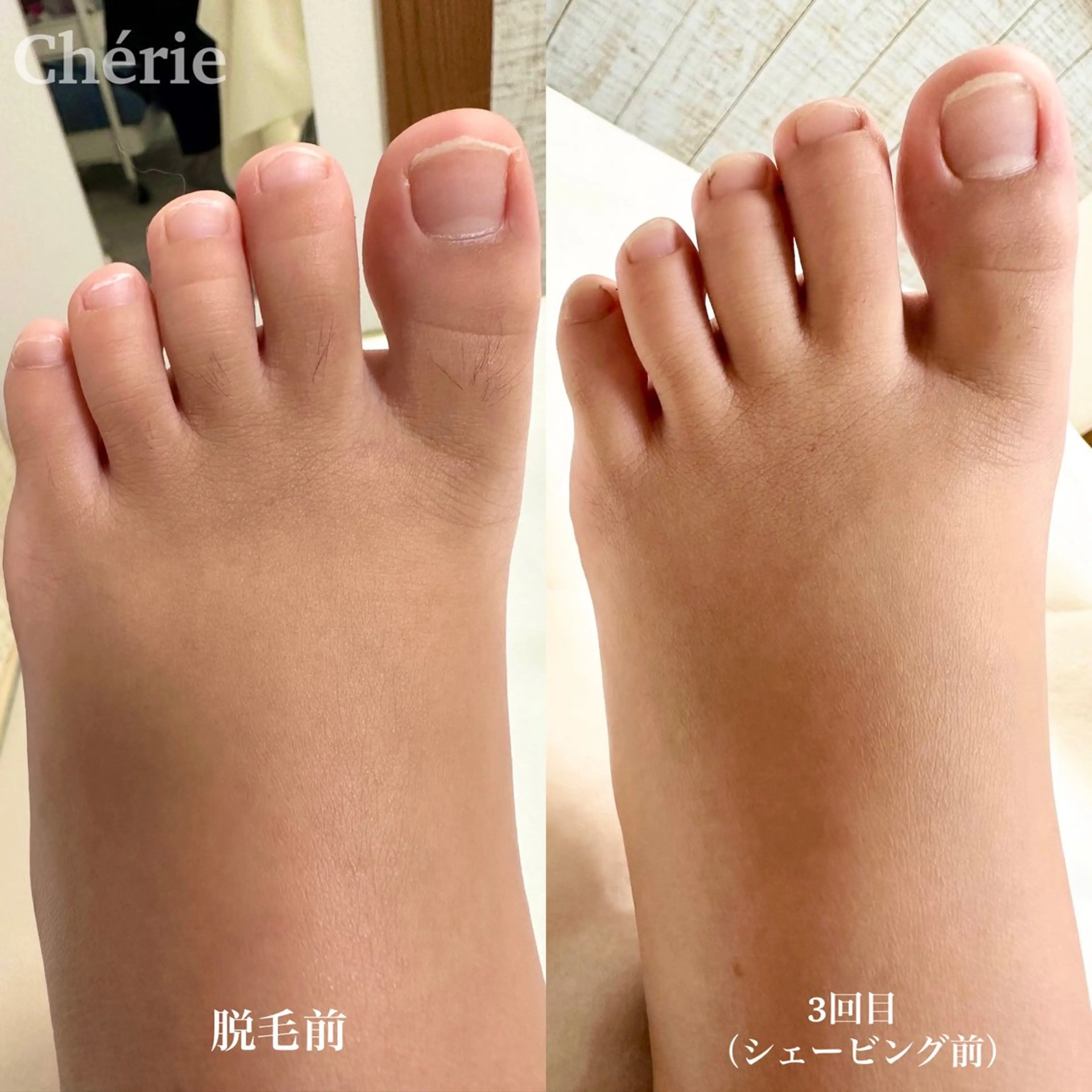 キッズ 大津 香（シェリー）のエステ・リラクイメージ