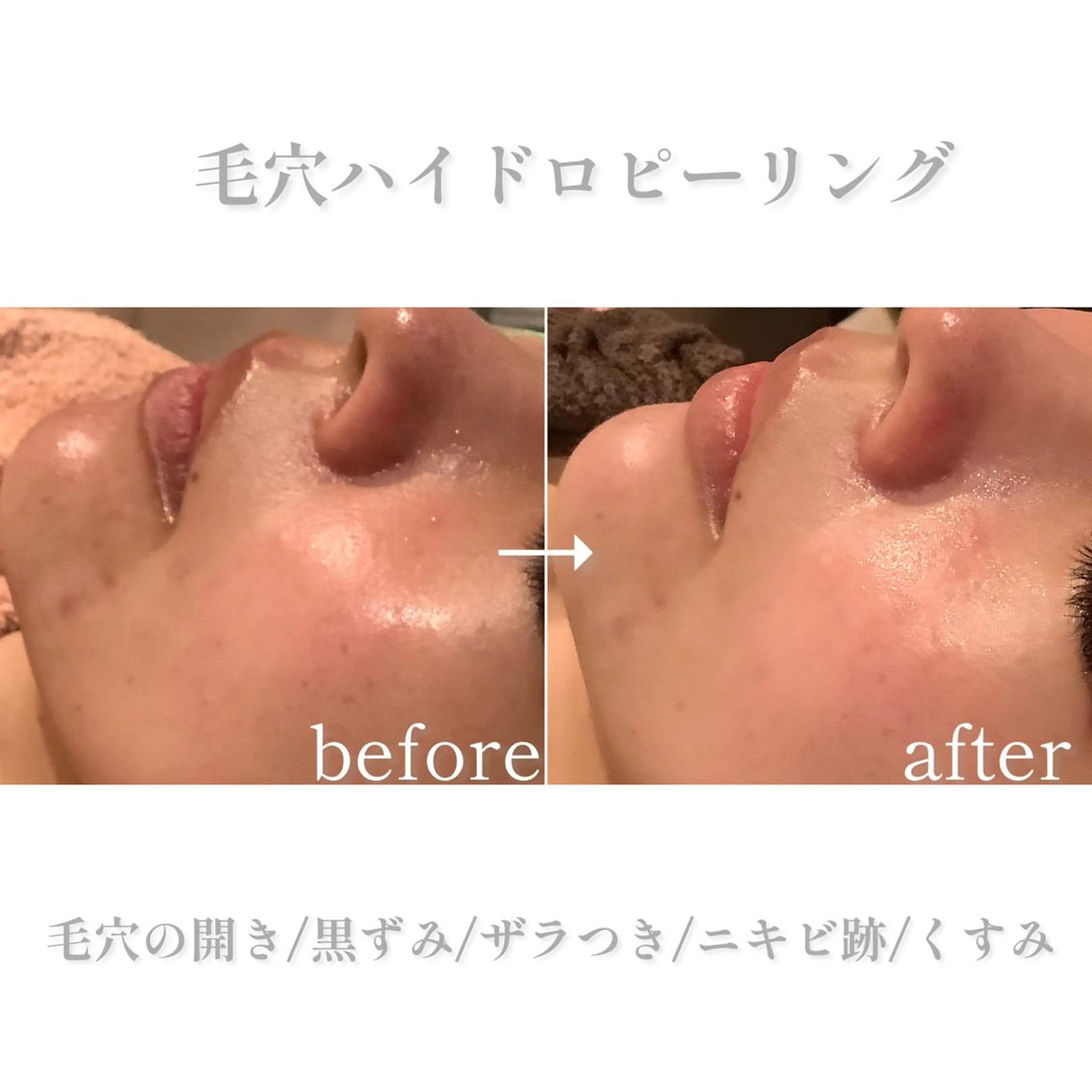 エステ 脱毛&エステサロン JIGGLY武蔵小山のエステ・リラクイメージ