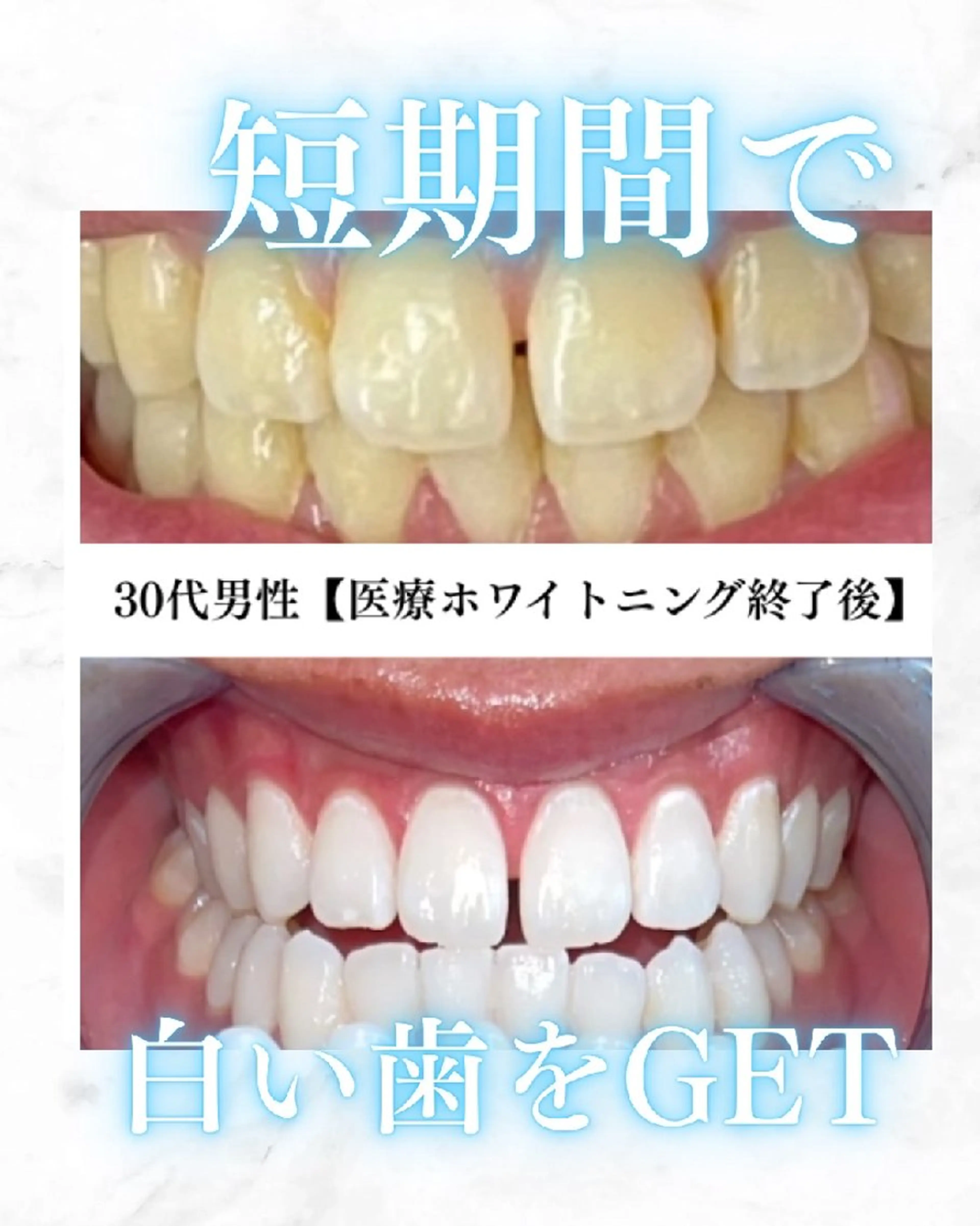 キッズ メンズ セルフホワイトニング WHITE福岡博多店のエステ・リラクイメージ