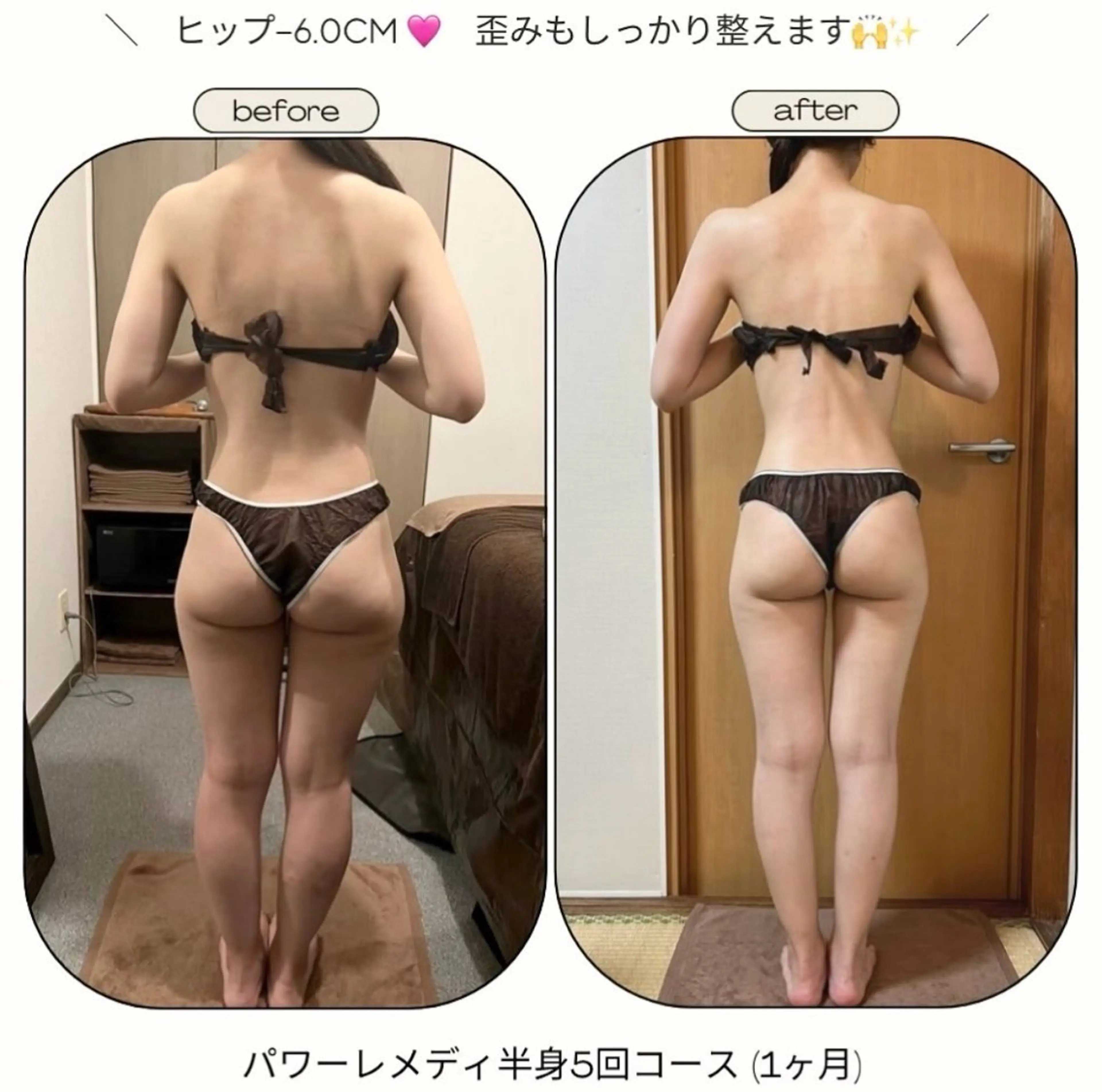 《本気痩せ×疲労改善 》  BILOOPのエステ・リラクイメージ