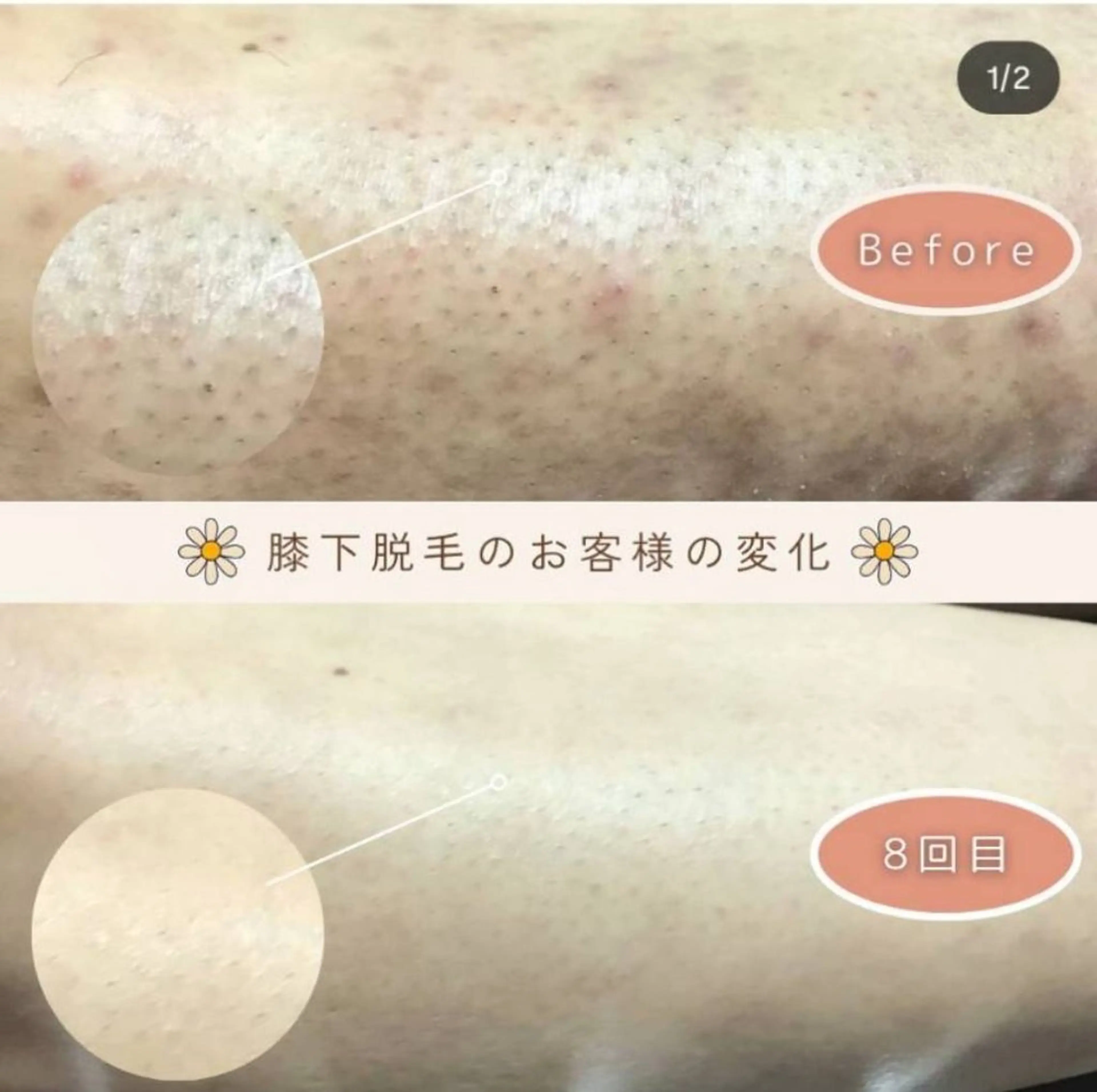 メンズ脱毛サロン リムーブ所属・メンズ脱毛サロン リムーブのエステ・リラクイメージ