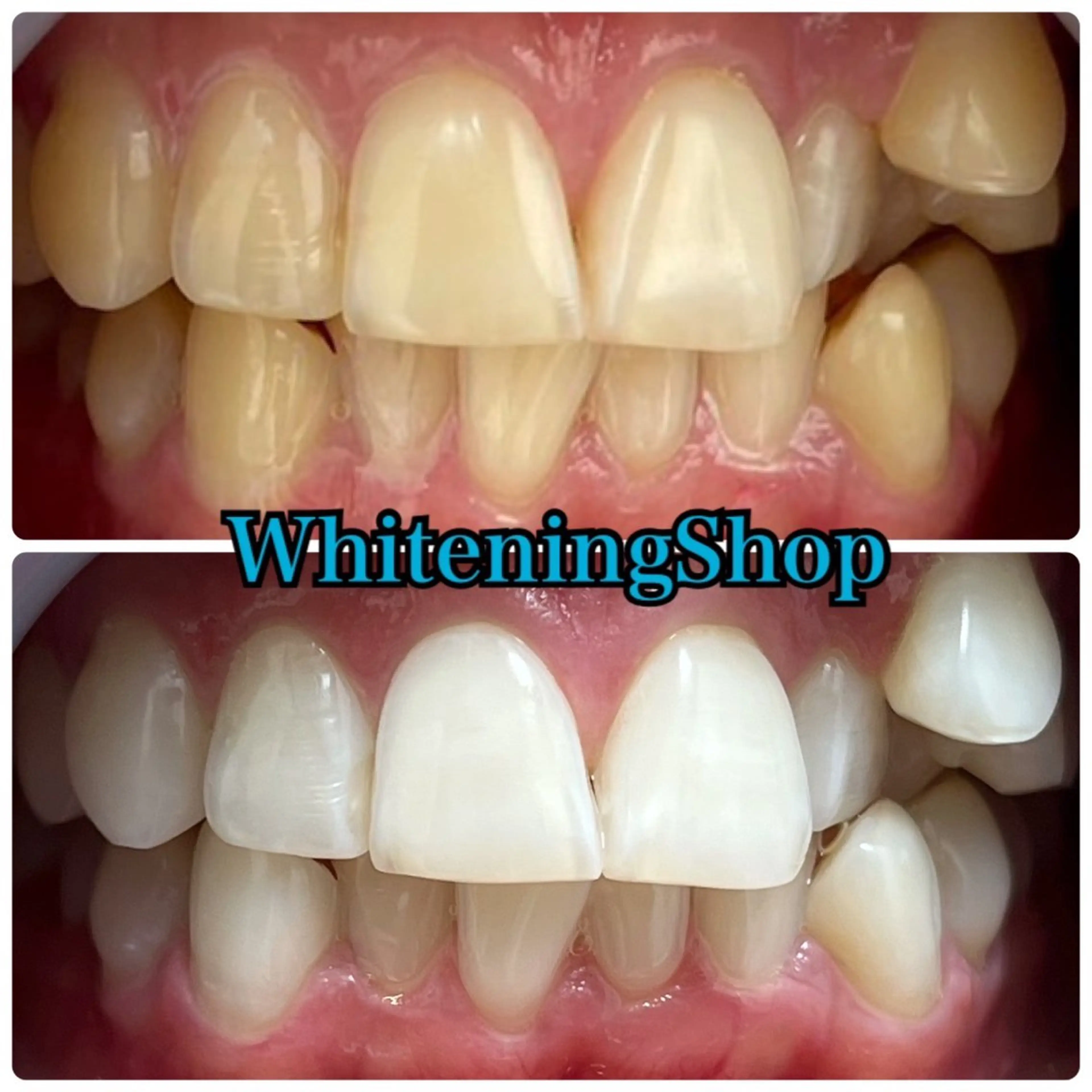 エステ リラク ホワイトニング ショップ吉祥寺店のエステ・リラクイメージ